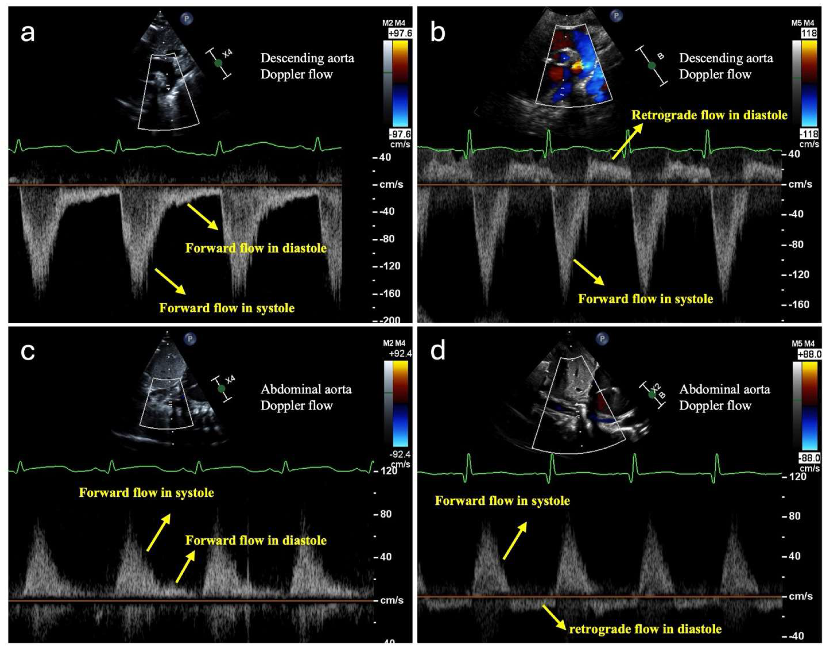 Jcdd 12 00038 g001 Jcdd 12 00038 g001