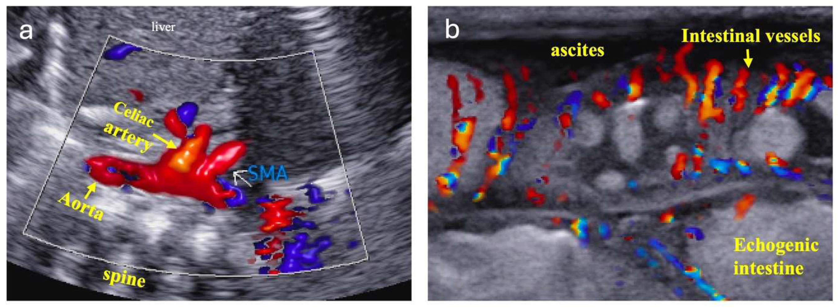 Jcdd 12 00038 g002 Jcdd 12 00038 g002