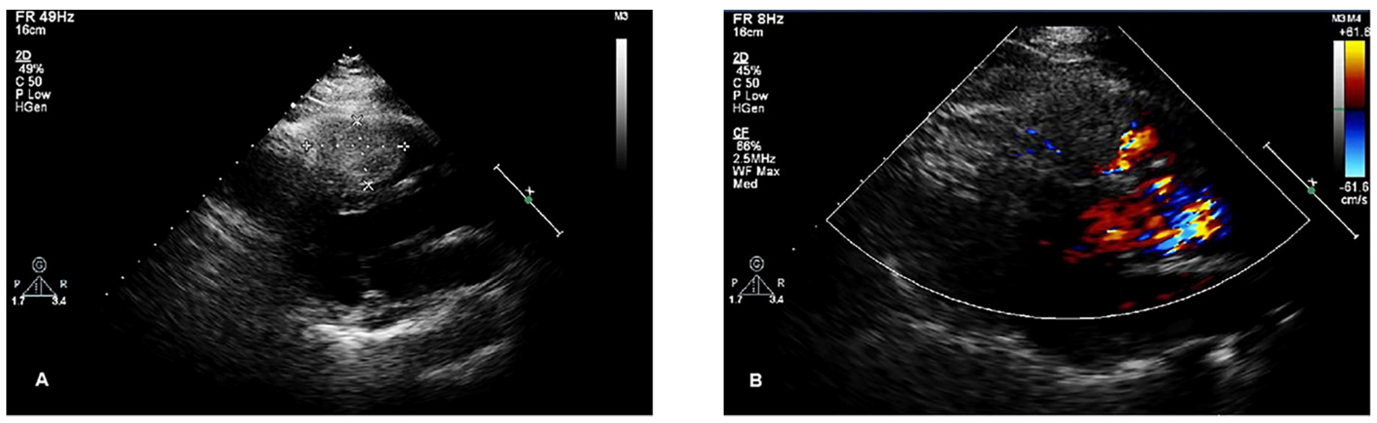 Jcdd 12 00045 g001 Jcdd 12 00045 g001
