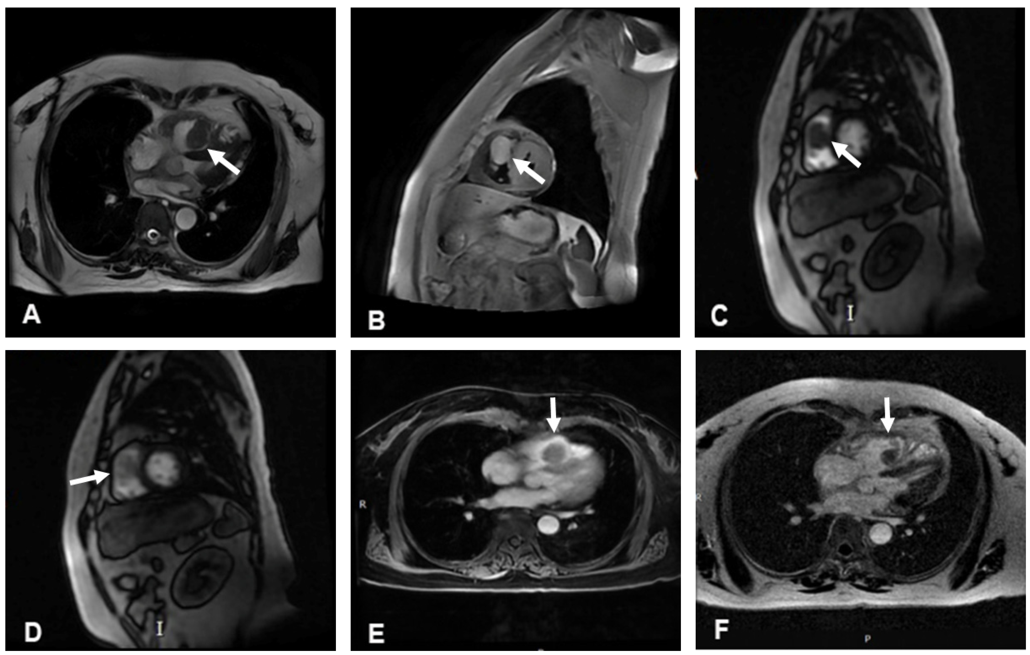 Jcdd 12 00045 g003 Jcdd 12 00045 g003