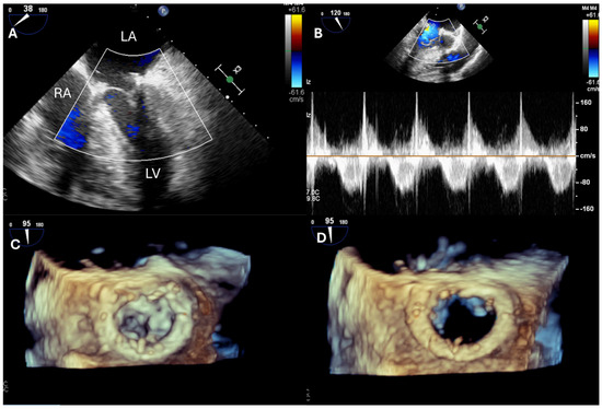 健康・医学 PERIOPERATIVE TRANSESOPHAGEAL Amazon | Perioperative Transesophageal Echocardiography Self