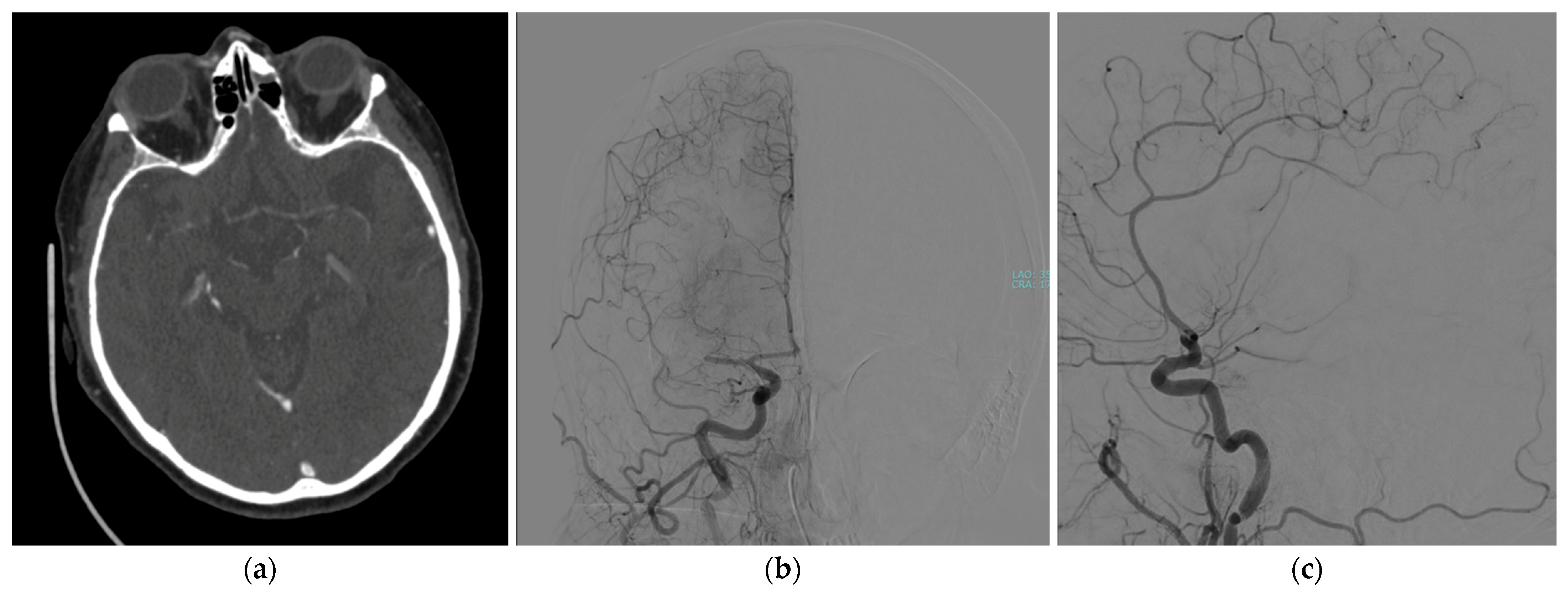 Jcdd 12 00146 g001 Jcdd 12 00146 g001