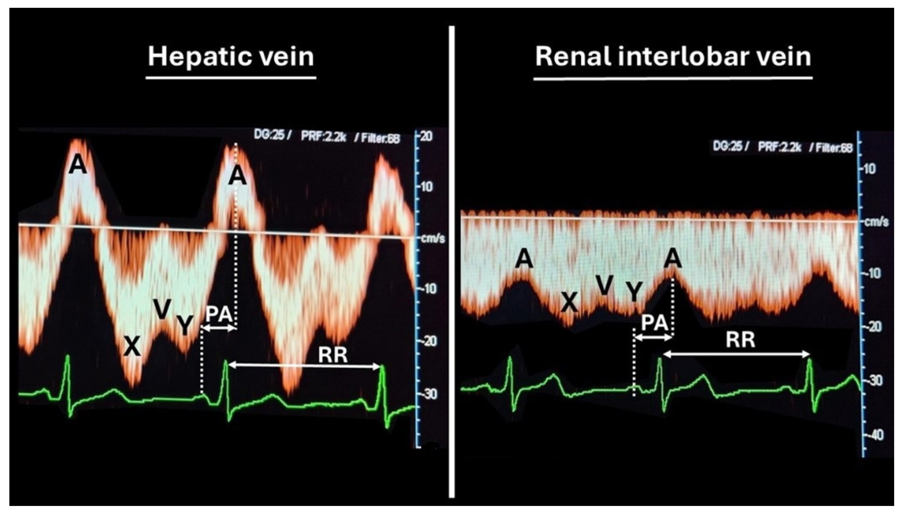 Jcdd 12 00193 g001 Jcdd 12 00193 g001