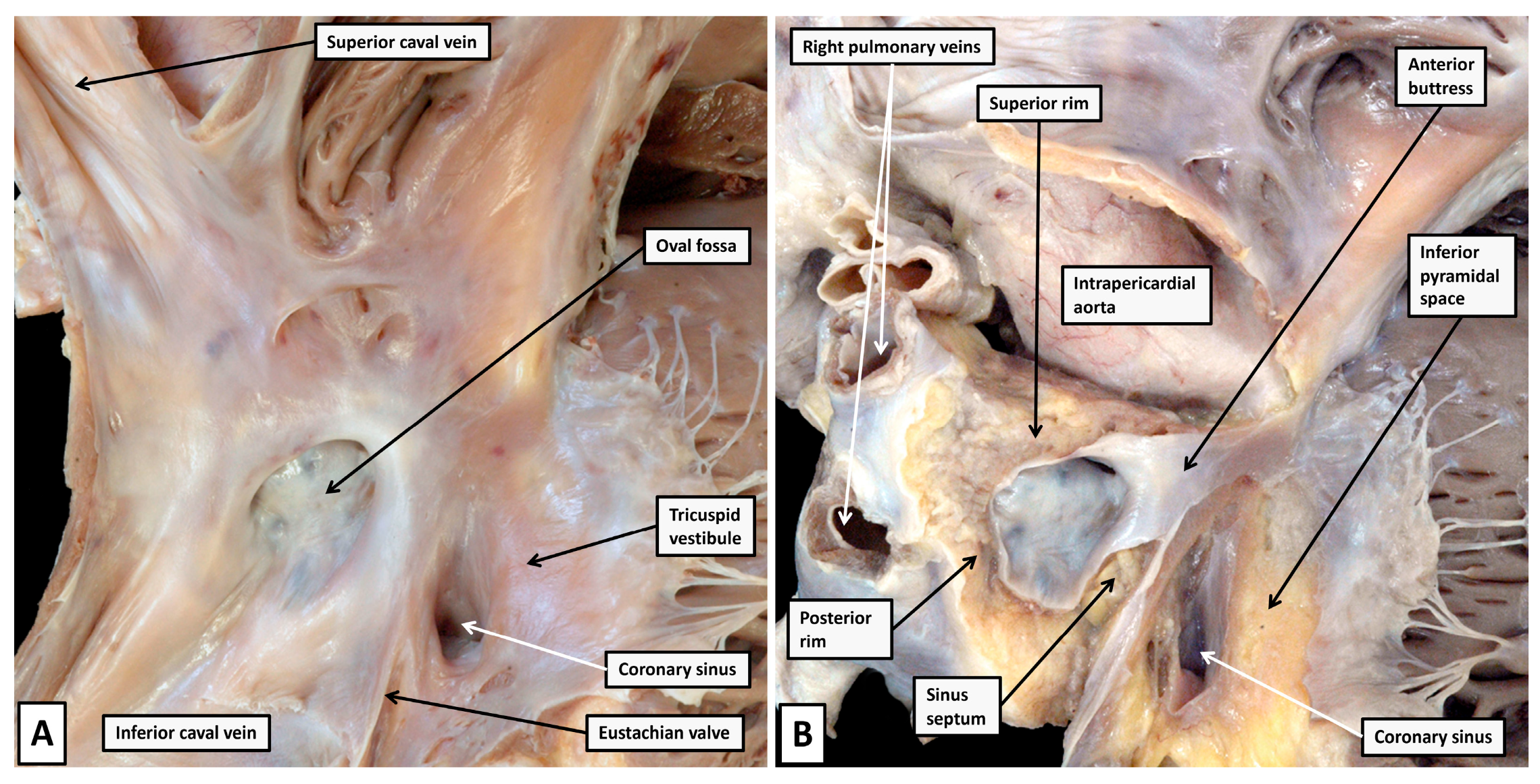 Jcdd 12 00245 g003 Jcdd 12 00245 g003
