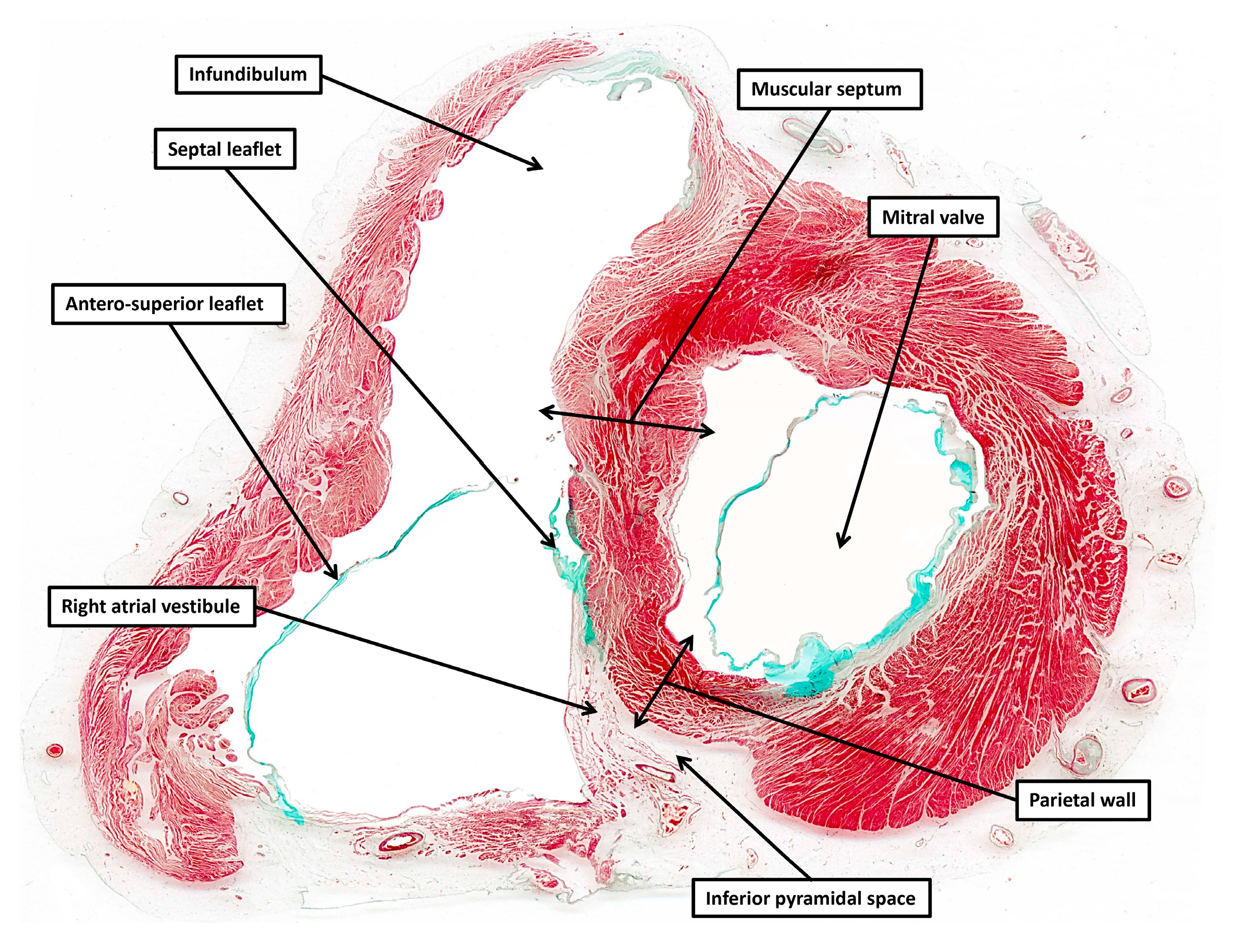 Jcdd 12 00245 g005 Jcdd 12 00245 g005