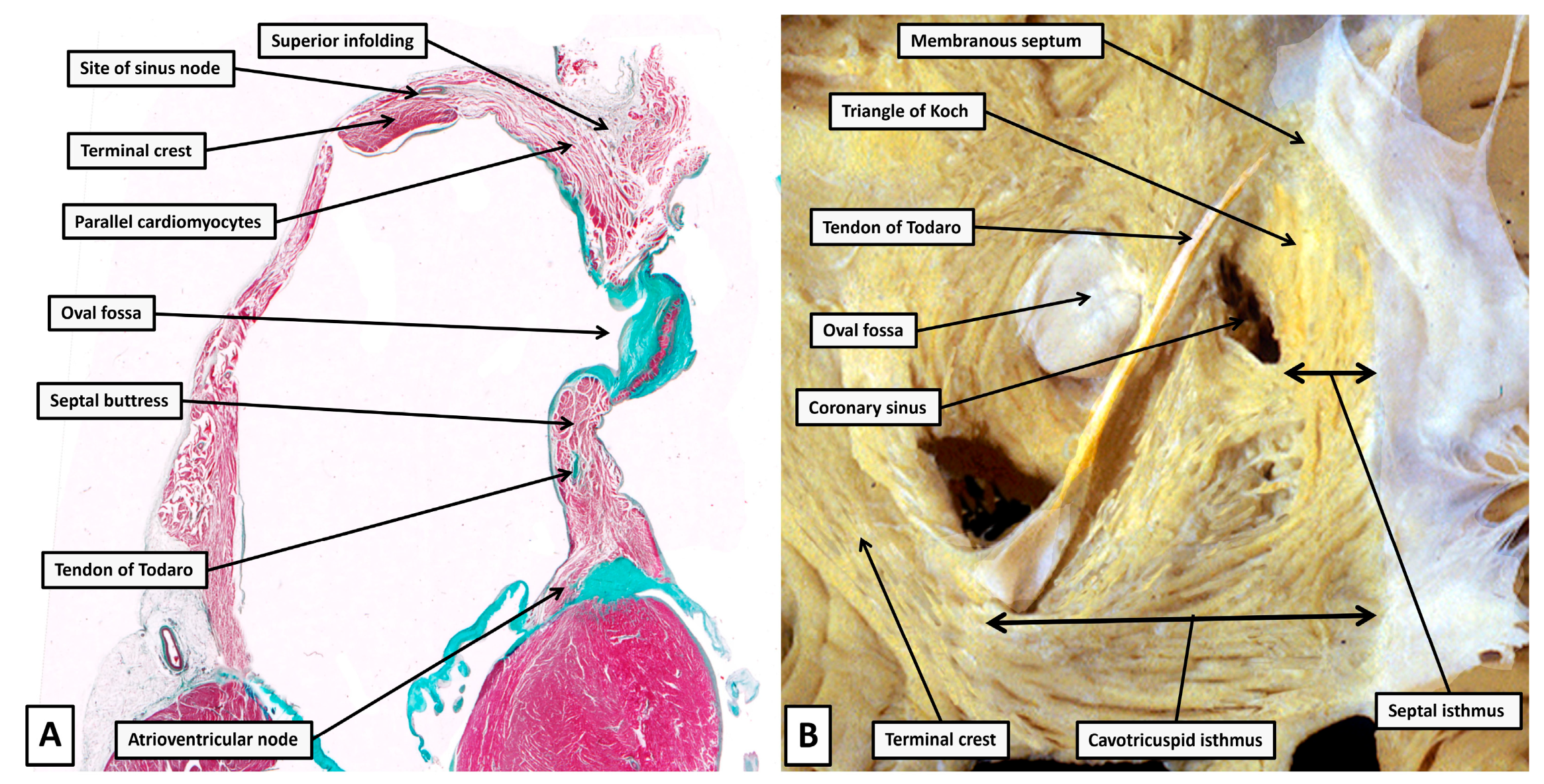 Jcdd 12 00245 g007 Jcdd 12 00245 g007