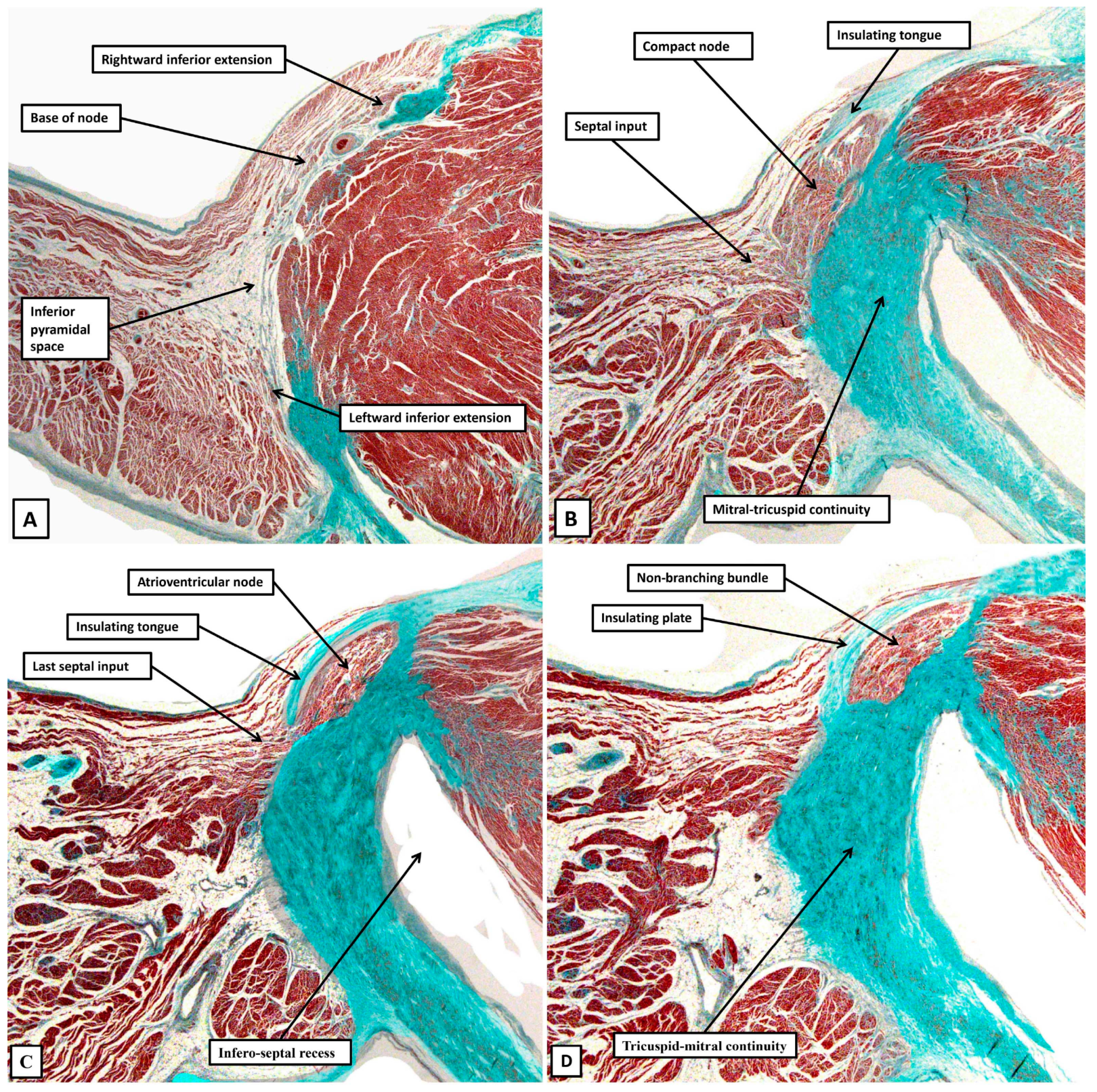 Jcdd 12 00245 g009 Jcdd 12 00245 g009