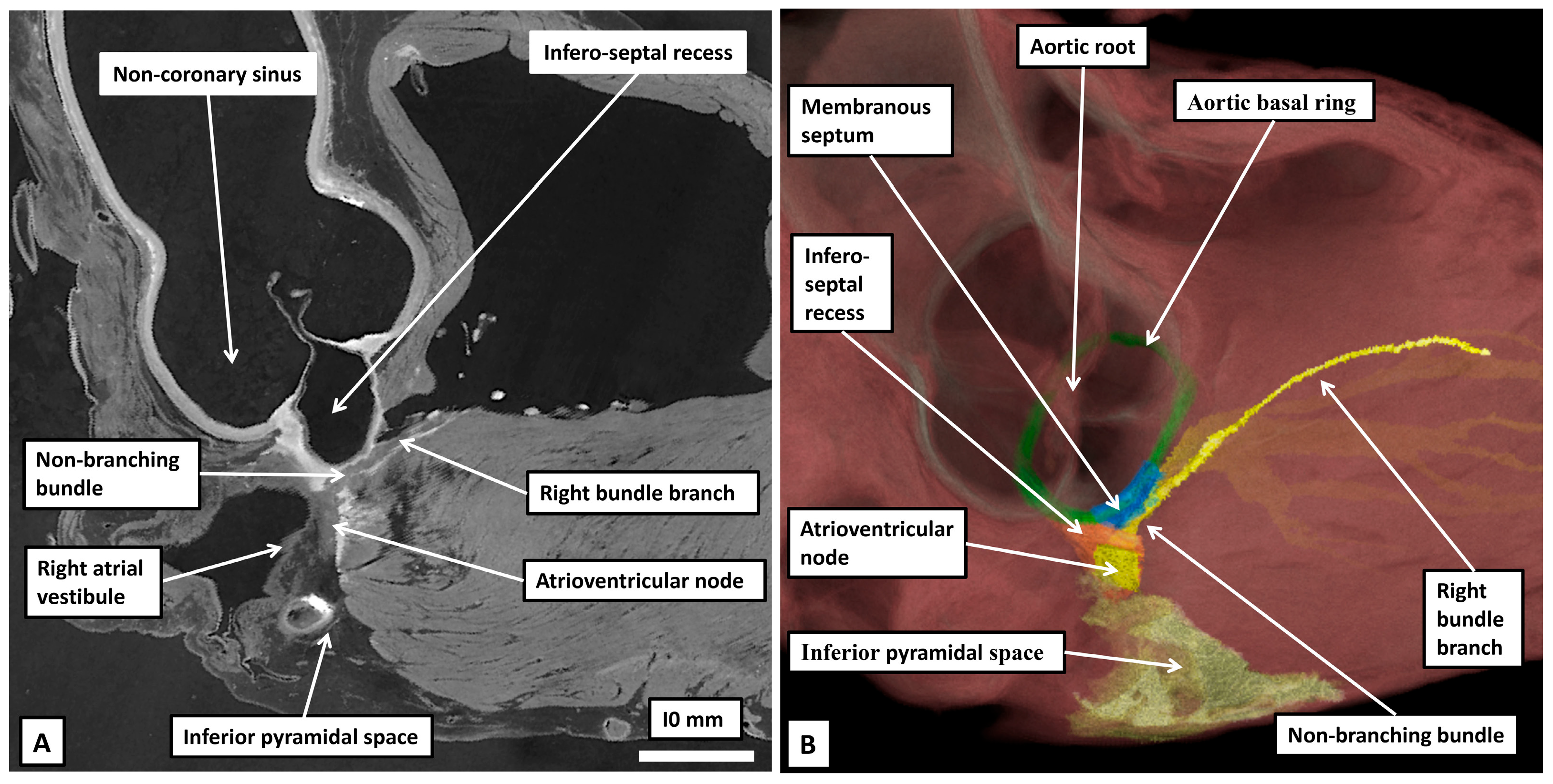 Jcdd 12 00245 g013 Jcdd 12 00245 g013