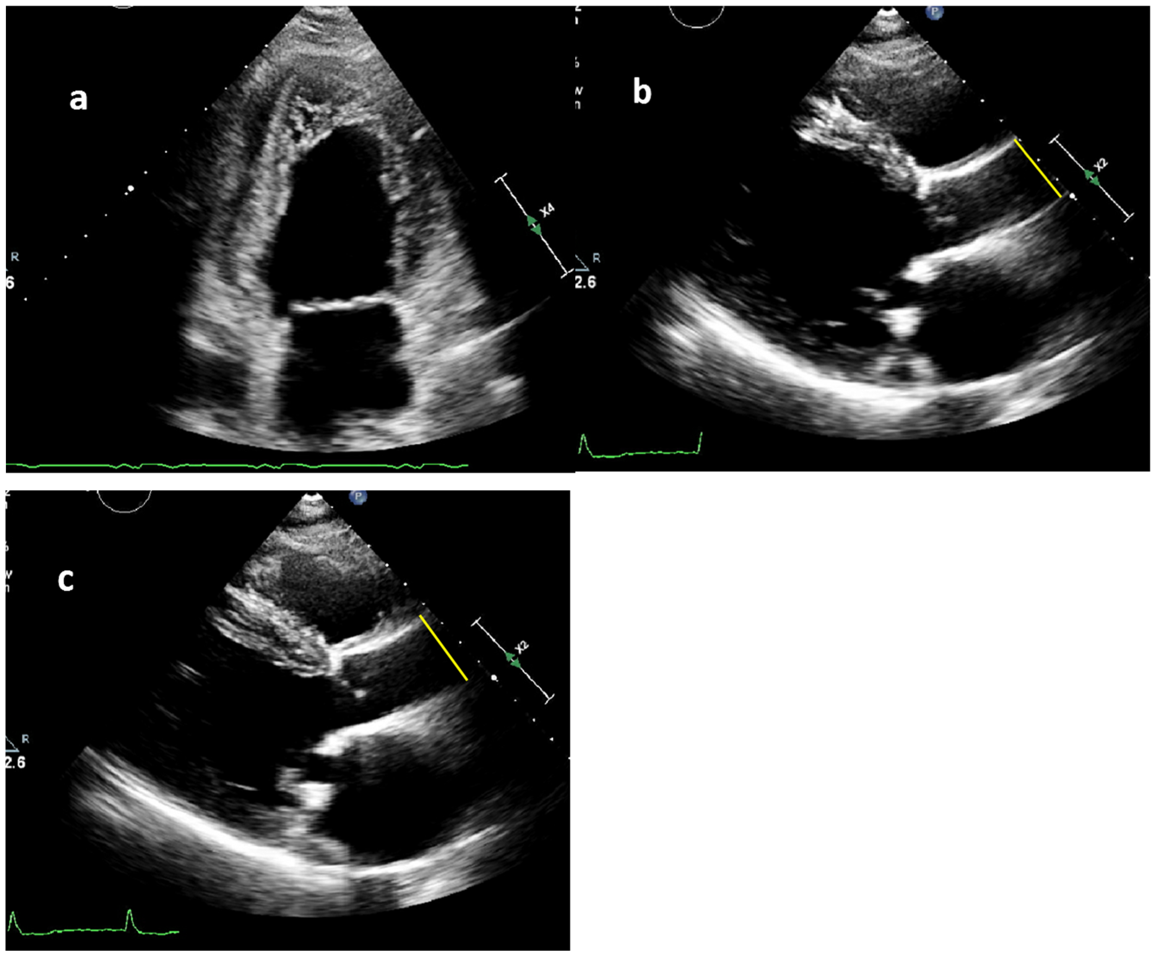 Jcdd 12 00303 g001 Jcdd 12 00303 g001