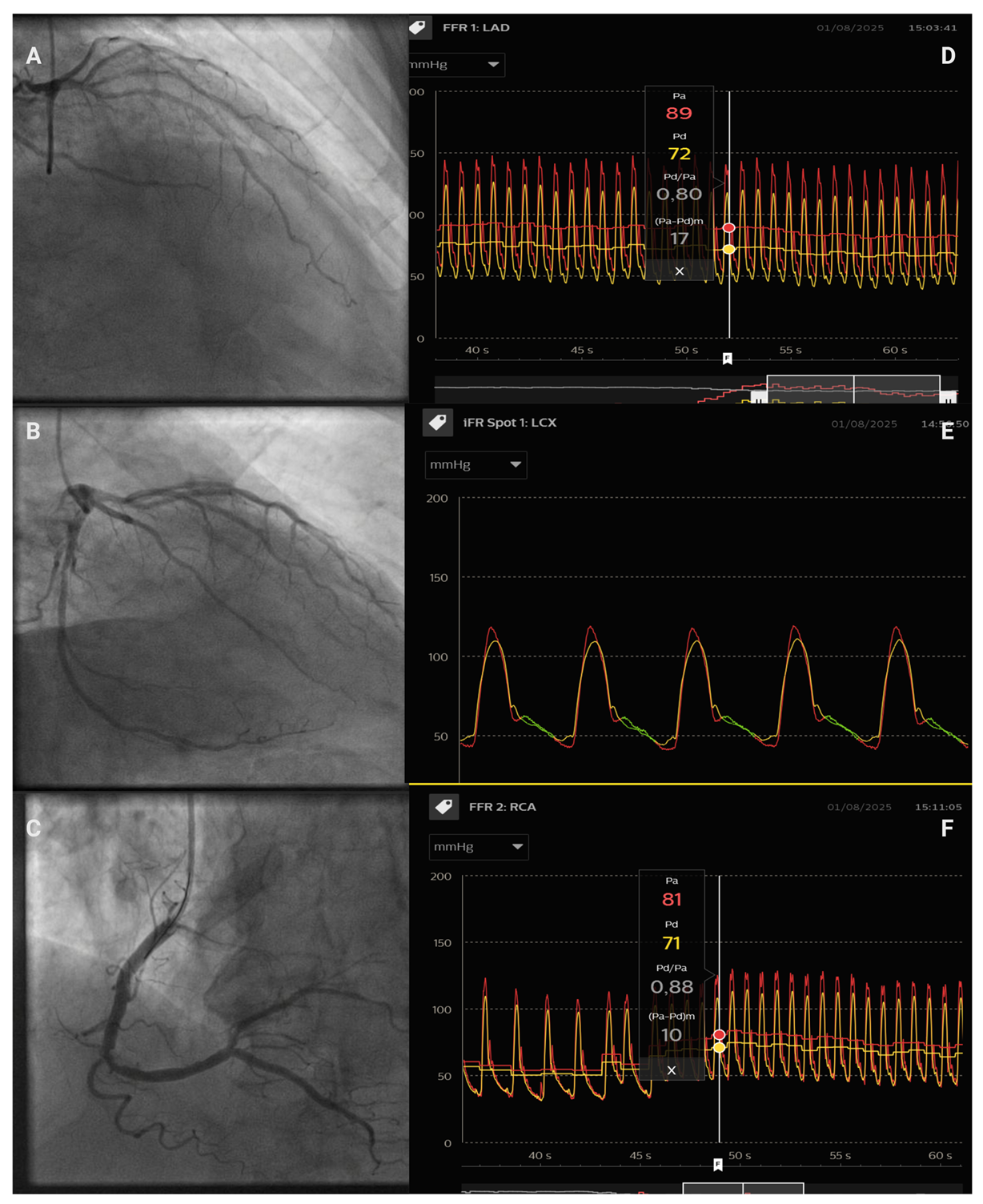 Jcdd 12 00319 g001 Jcdd 12 00319 g001