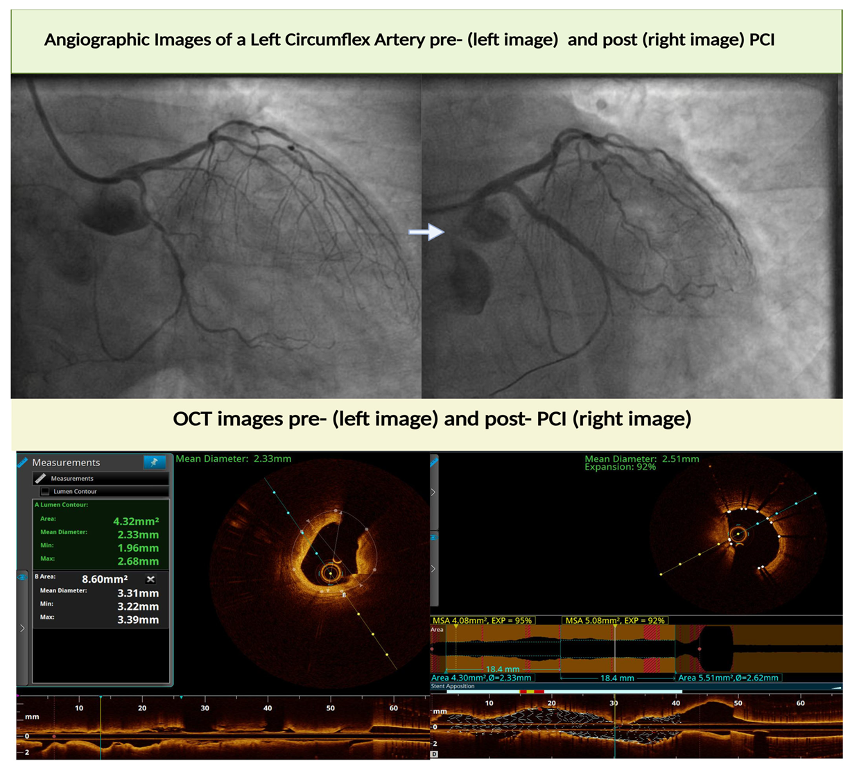 Jcdd 12 00319 g003 Jcdd 12 00319 g003