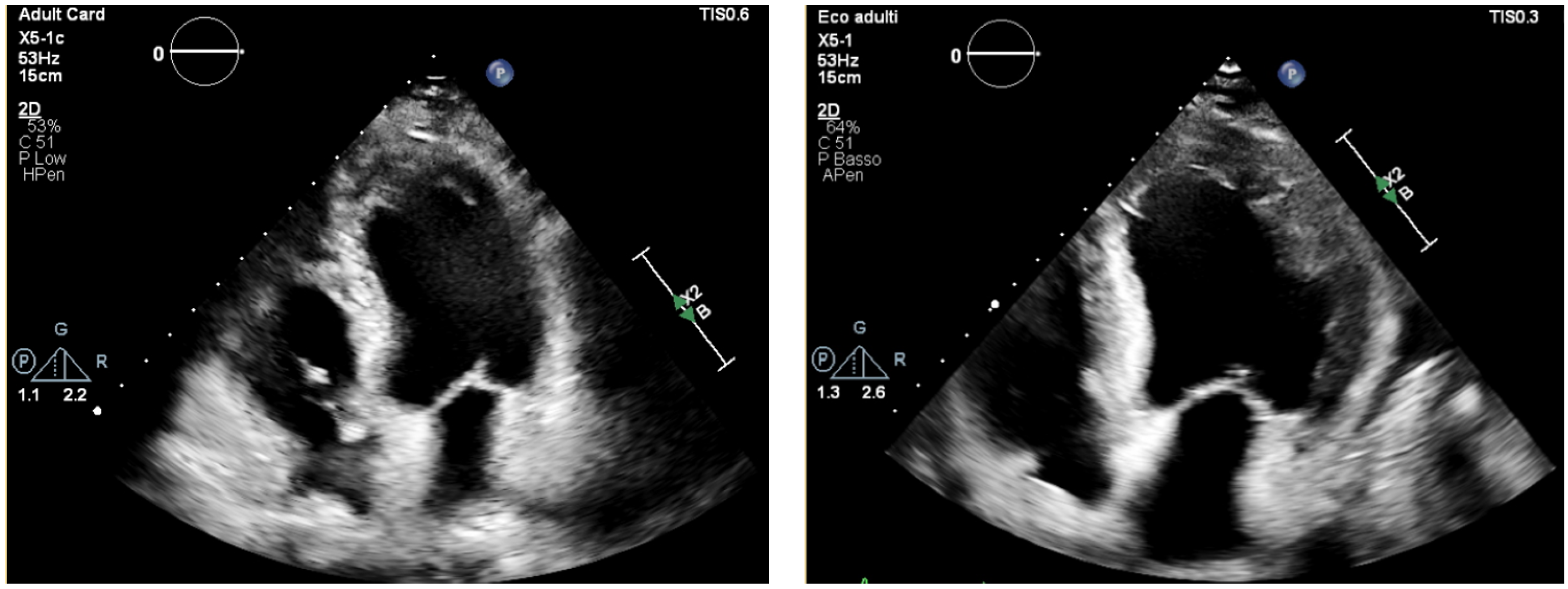 Jcdd 12 00320 g002 Jcdd 12 00320 g002