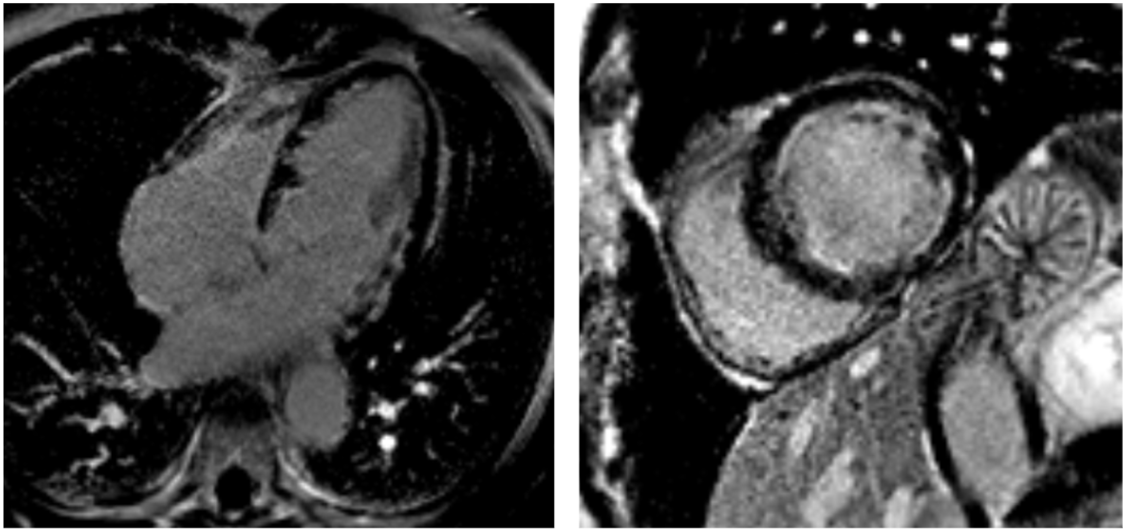 Jcdd 12 00320 g004 Jcdd 12 00320 g004