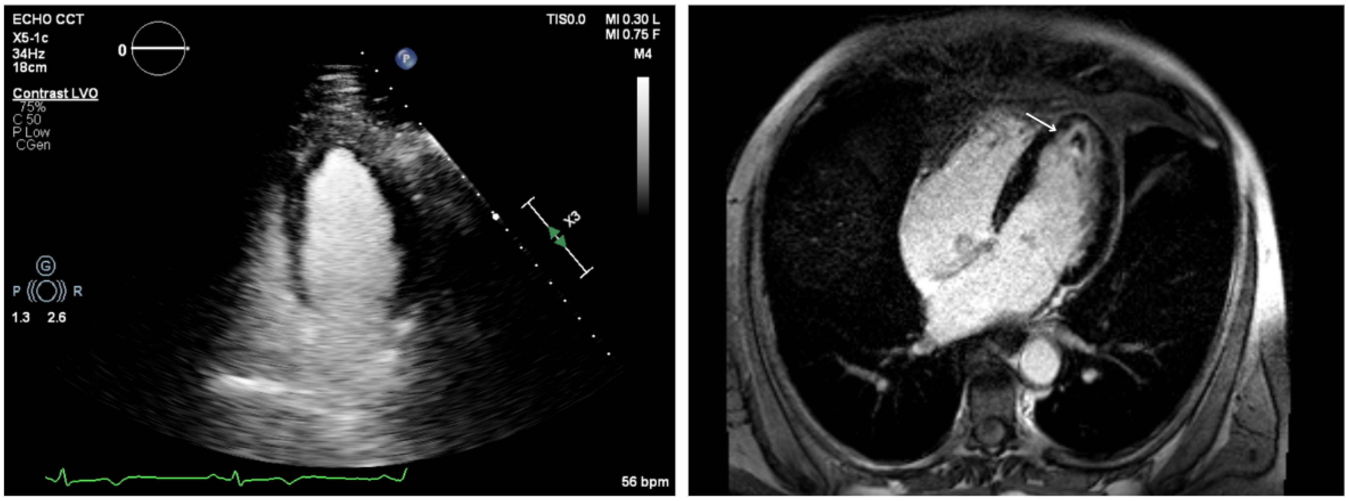 Jcdd 12 00320 g005 Jcdd 12 00320 g005
