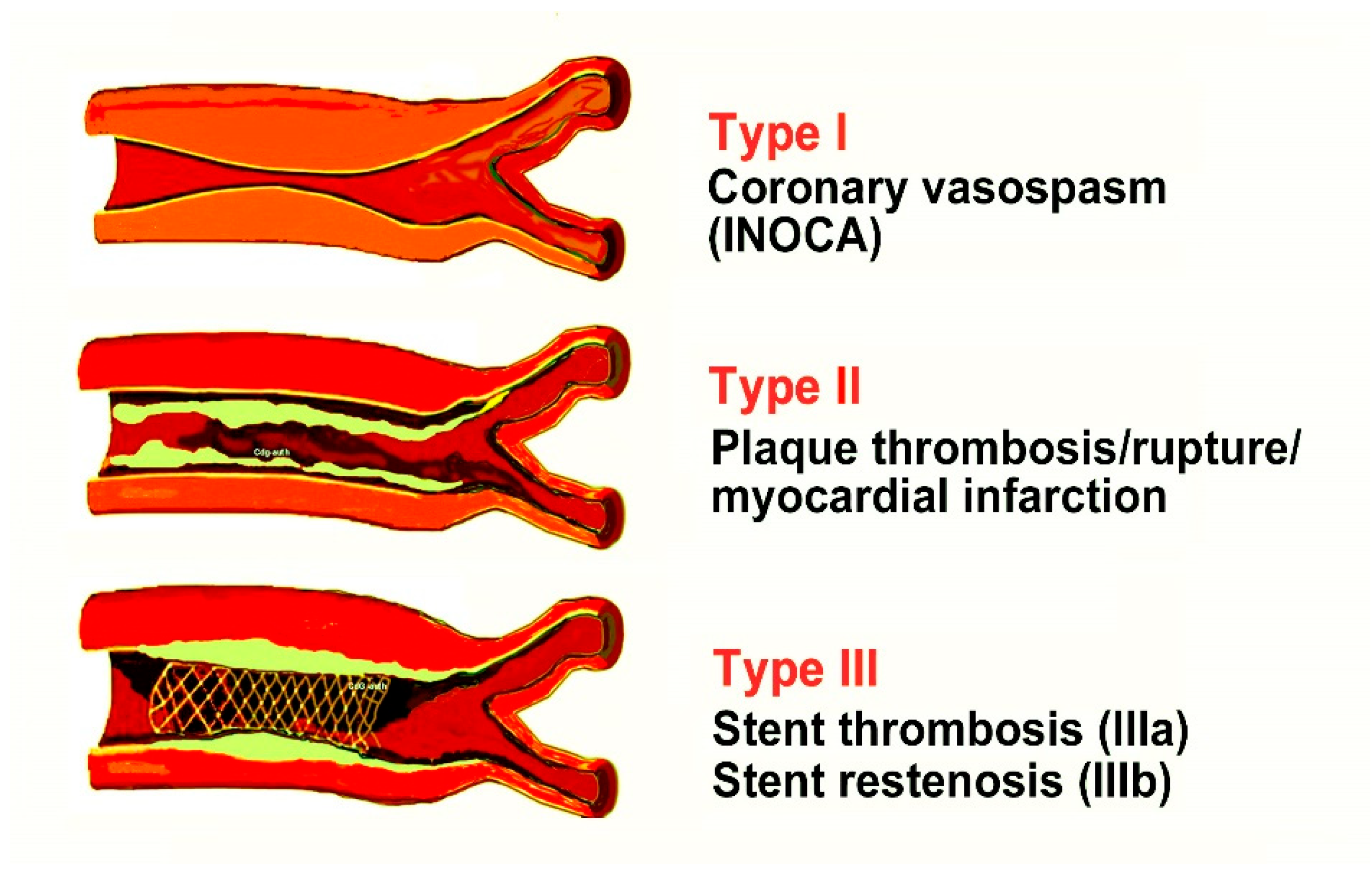 Jcdd 12 00325 g002 Jcdd 12 00325 g002