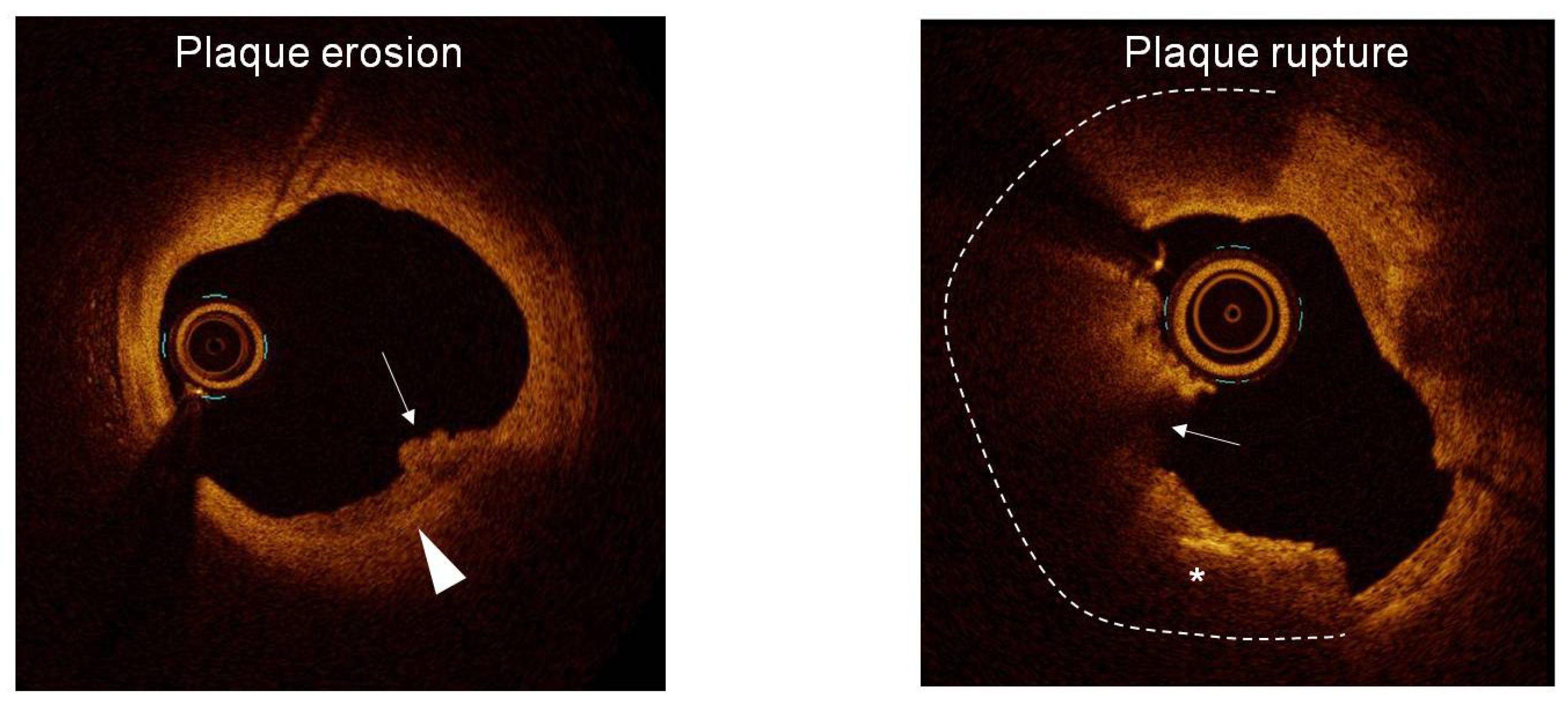 Jcdd 12 00335 g004 Jcdd 12 00335 g004