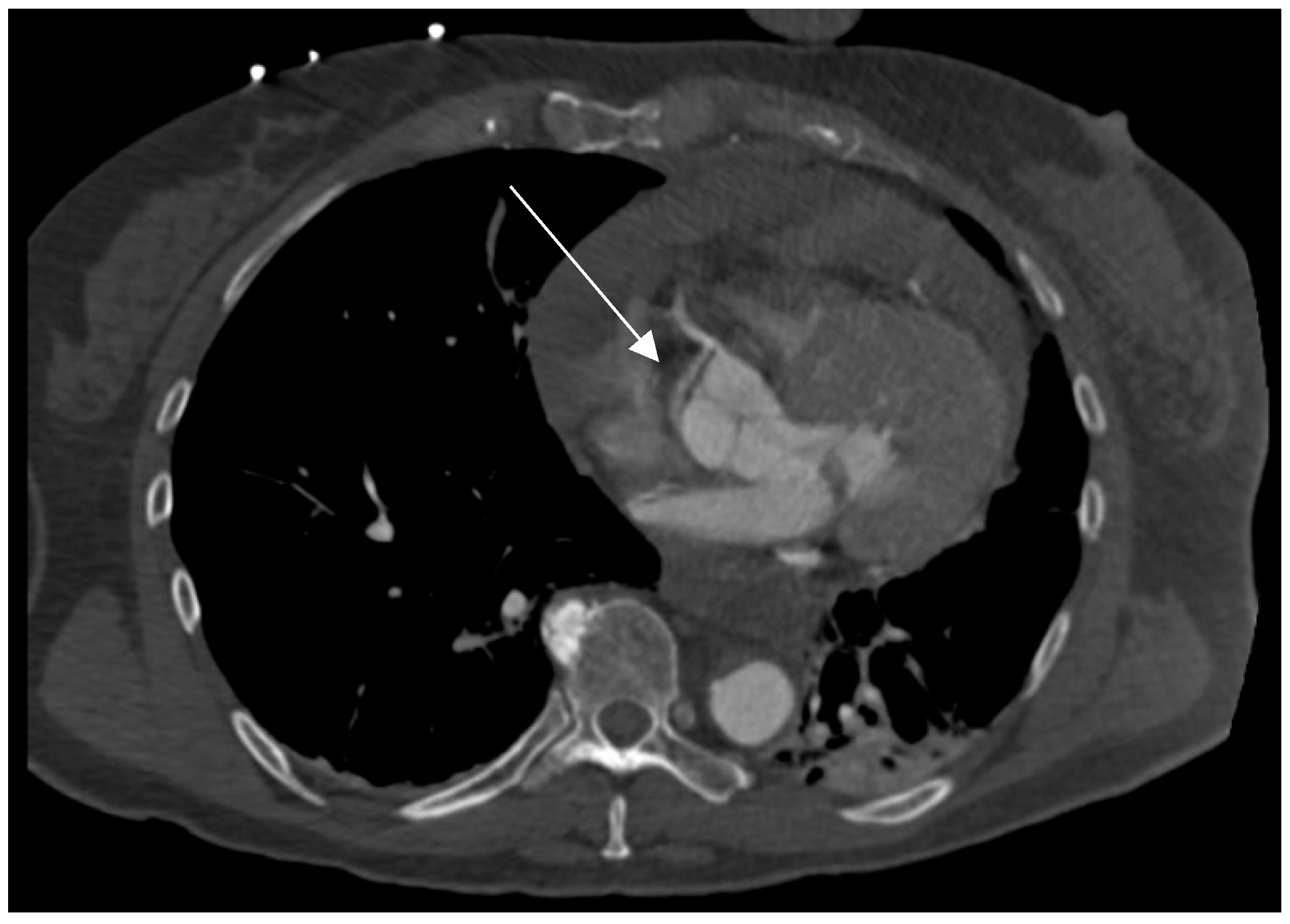 Jcdd 12 00336 g002 Jcdd 12 00336 g002