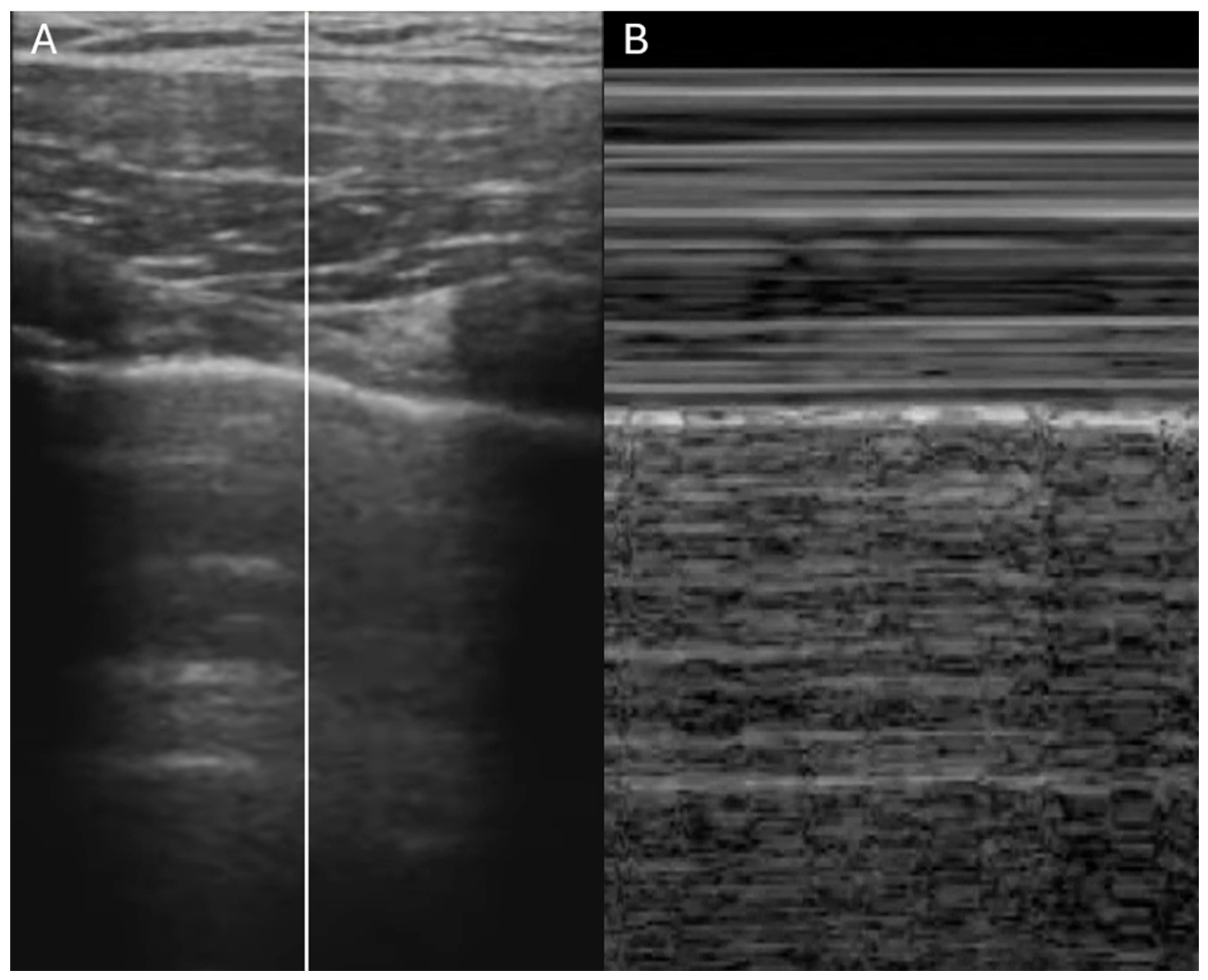 Jcdd 12 00379 g004 Jcdd 12 00379 g004