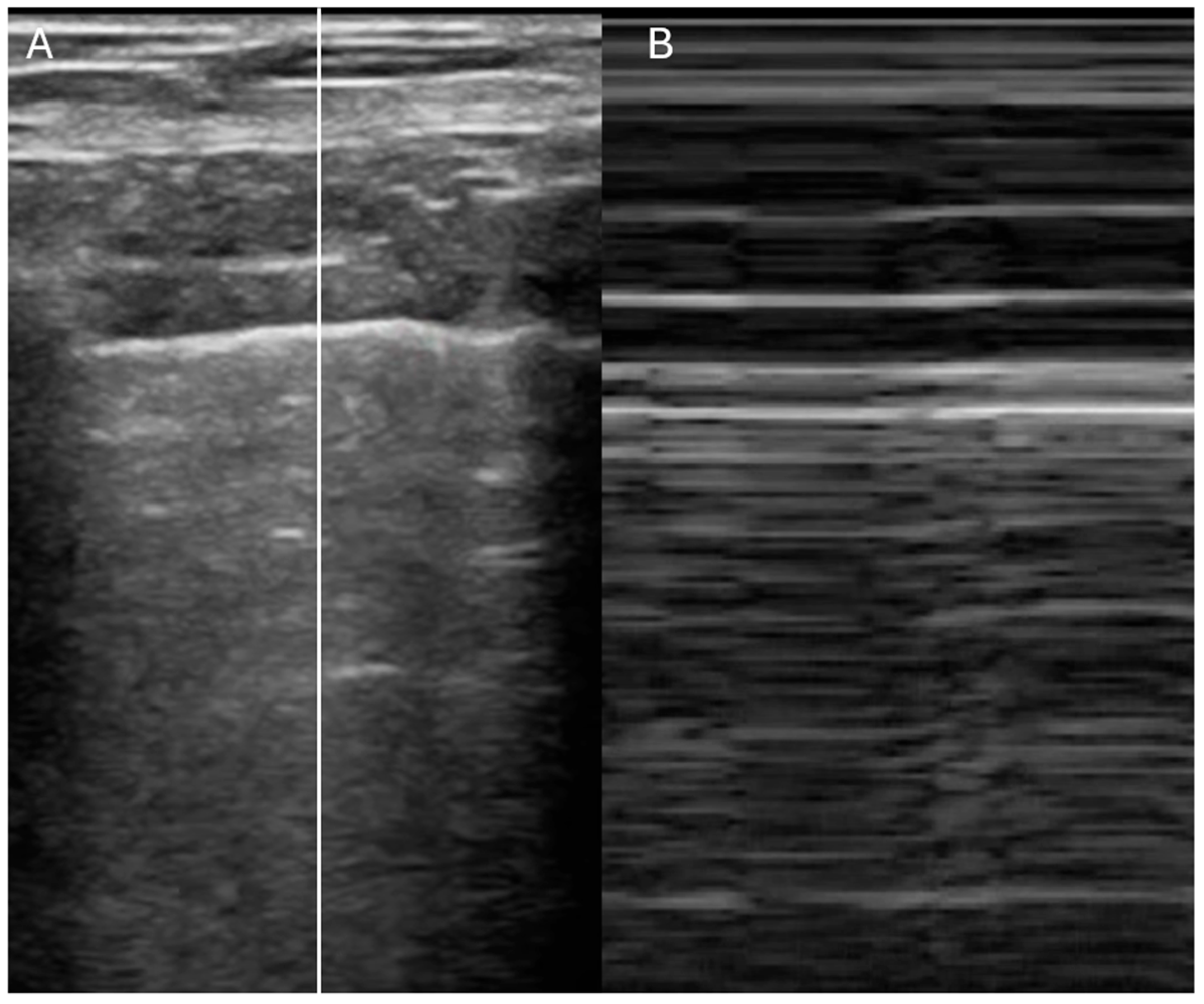 Jcdd 12 00379 g005 Jcdd 12 00379 g005