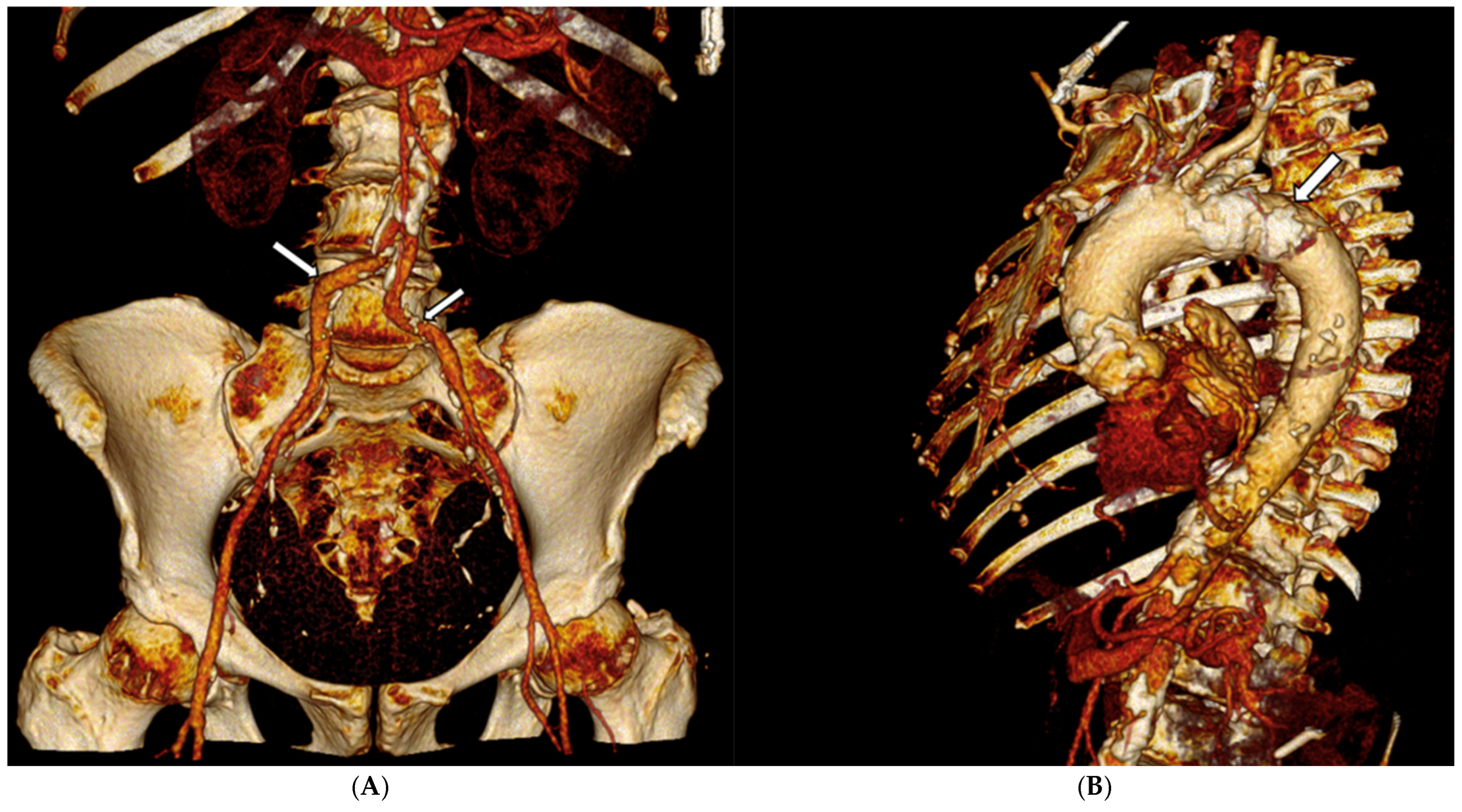 Jcdd 12 00396 g001 Jcdd 12 00396 g001