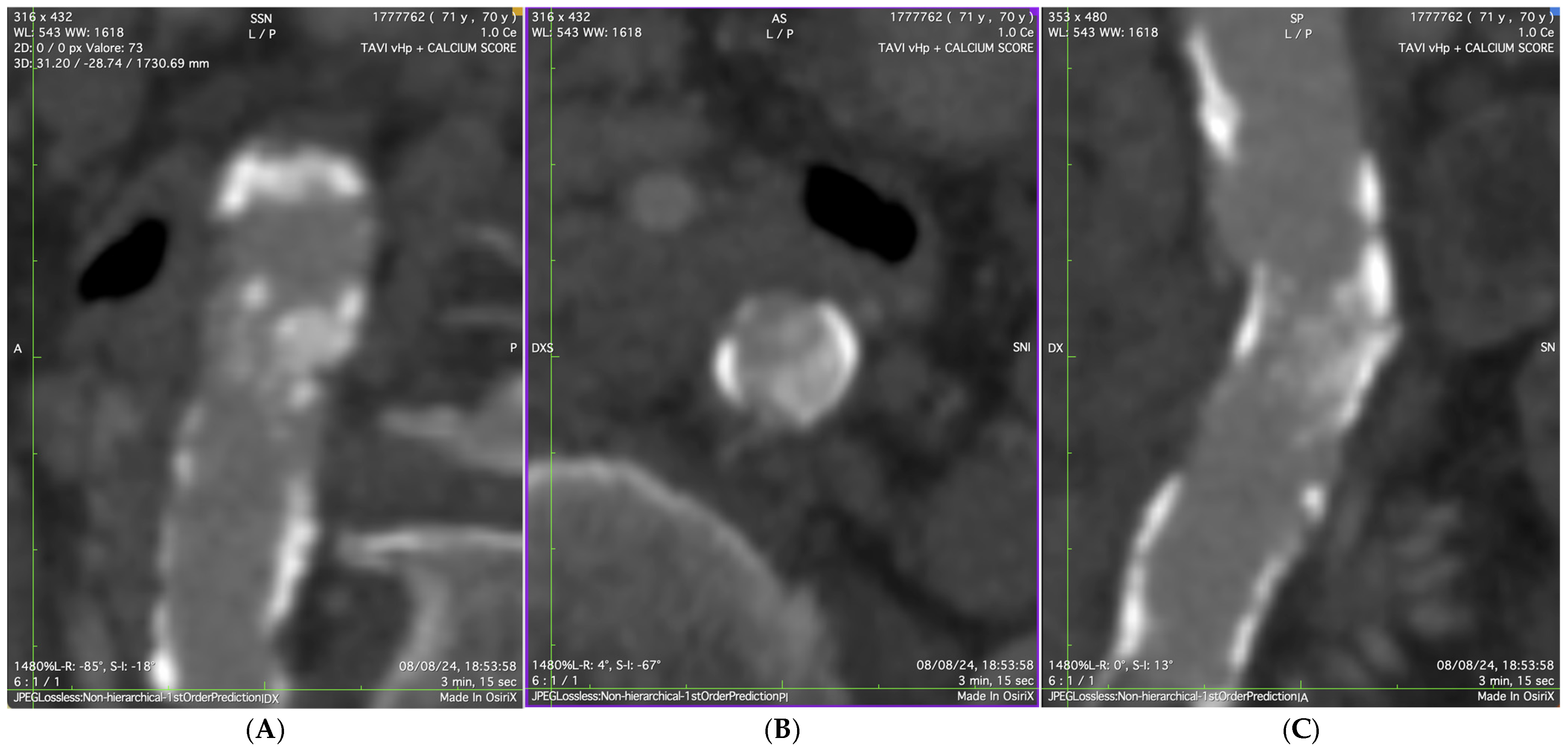 Jcdd 12 00396 g002 Jcdd 12 00396 g002