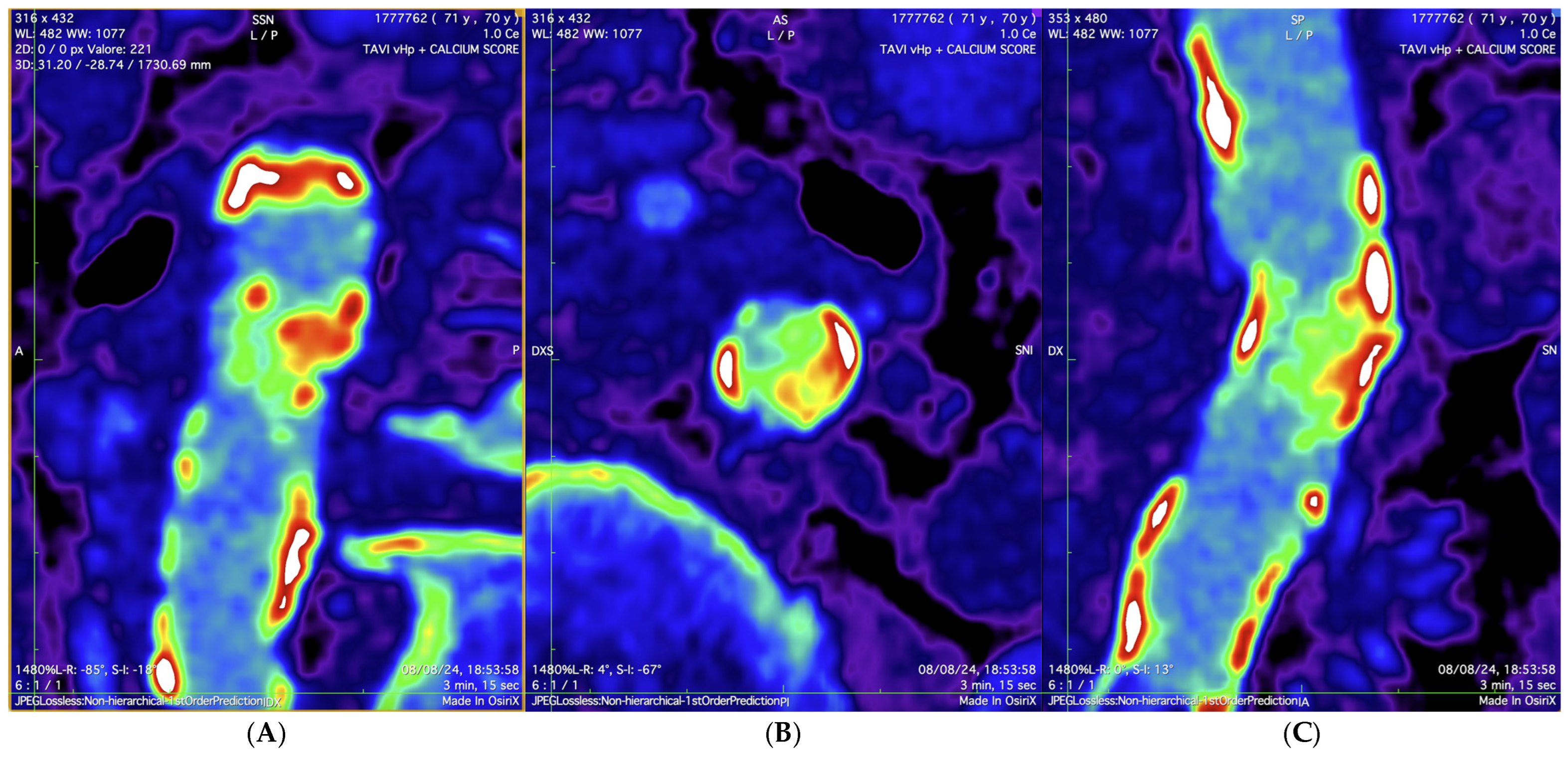 Jcdd 12 00396 g003 Jcdd 12 00396 g003