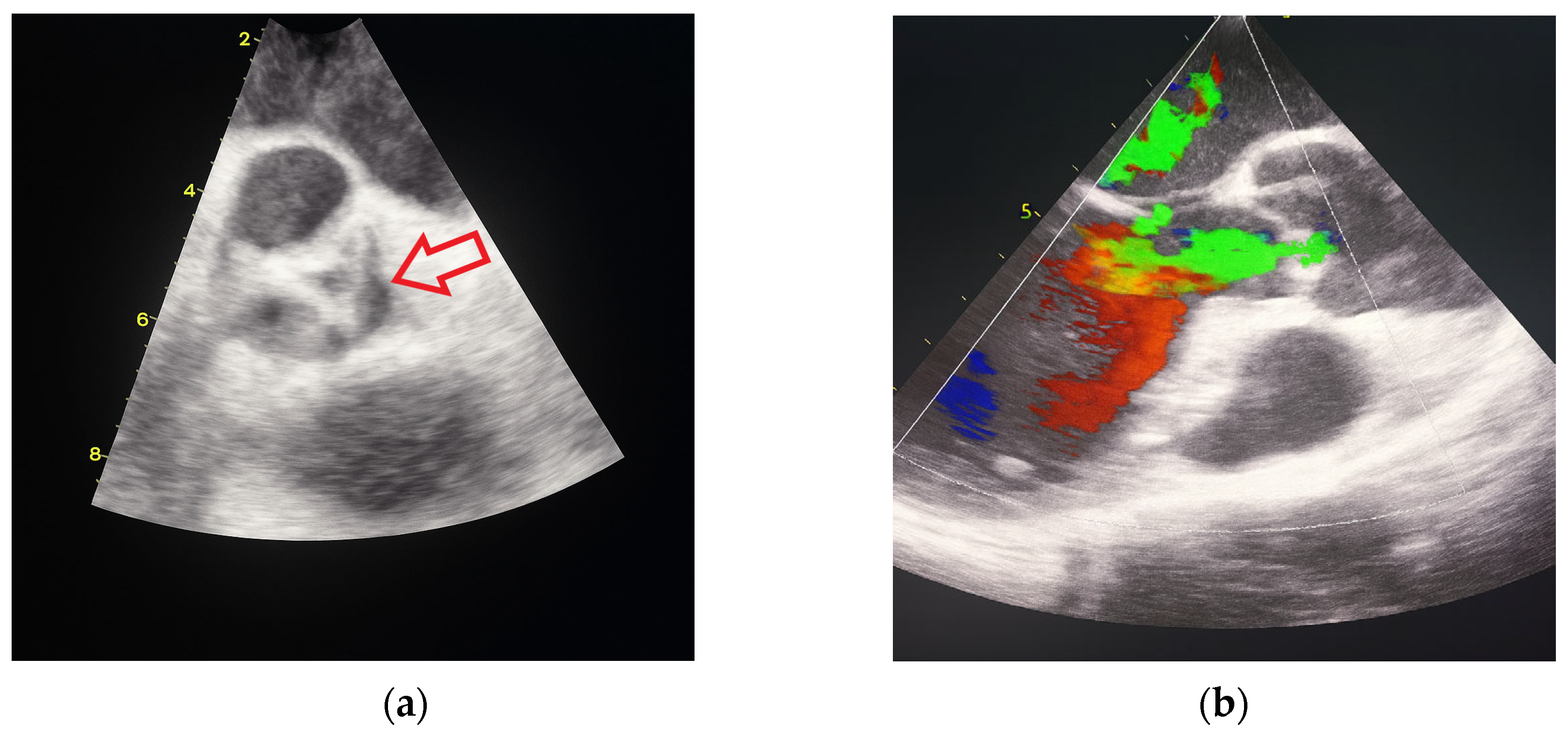 Jcdd 12 00408 g002 Jcdd 12 00408 g002