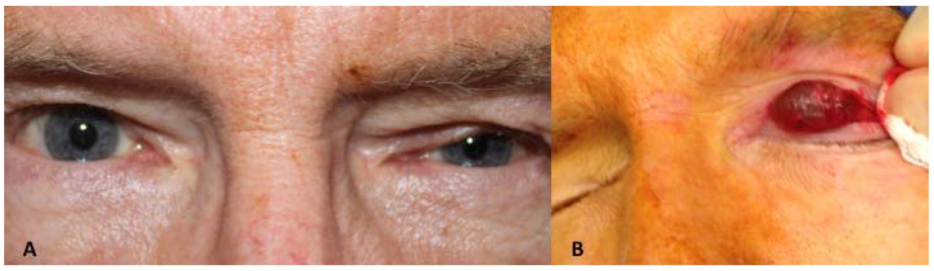 Jcm 04 00150 g003a 1024