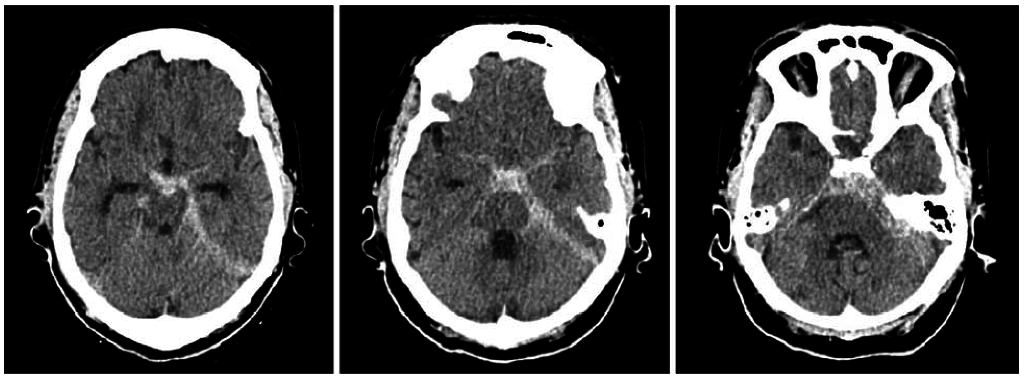 Jcm 04 00756 g002