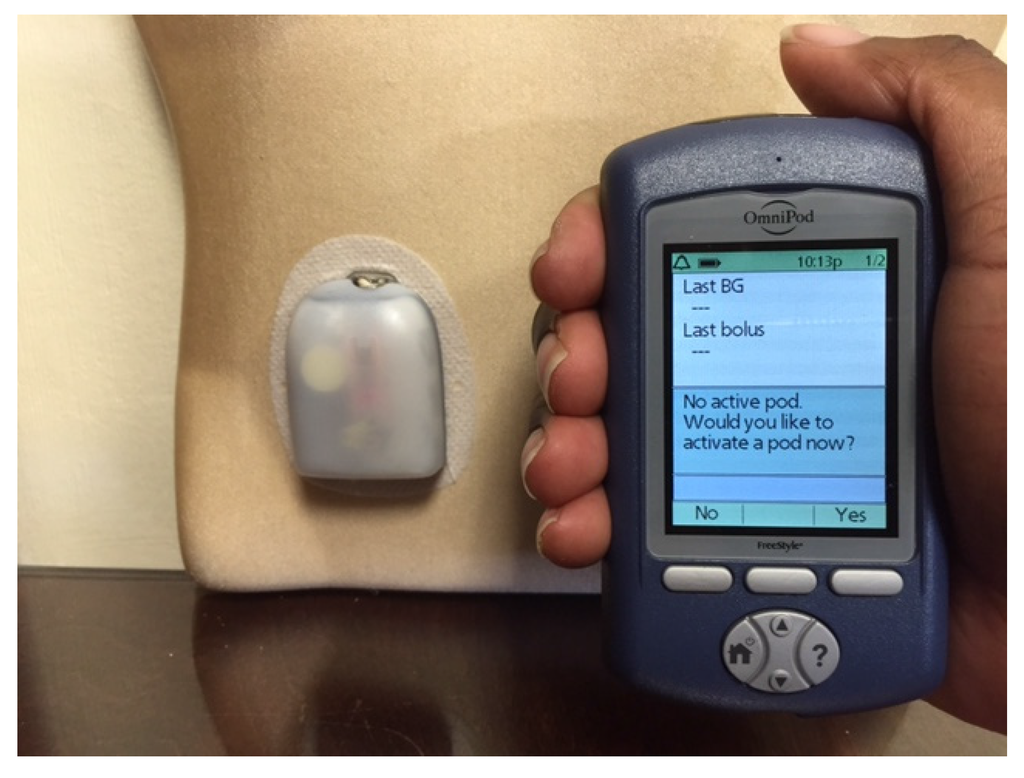 Omnipod 5 Insulin Pump