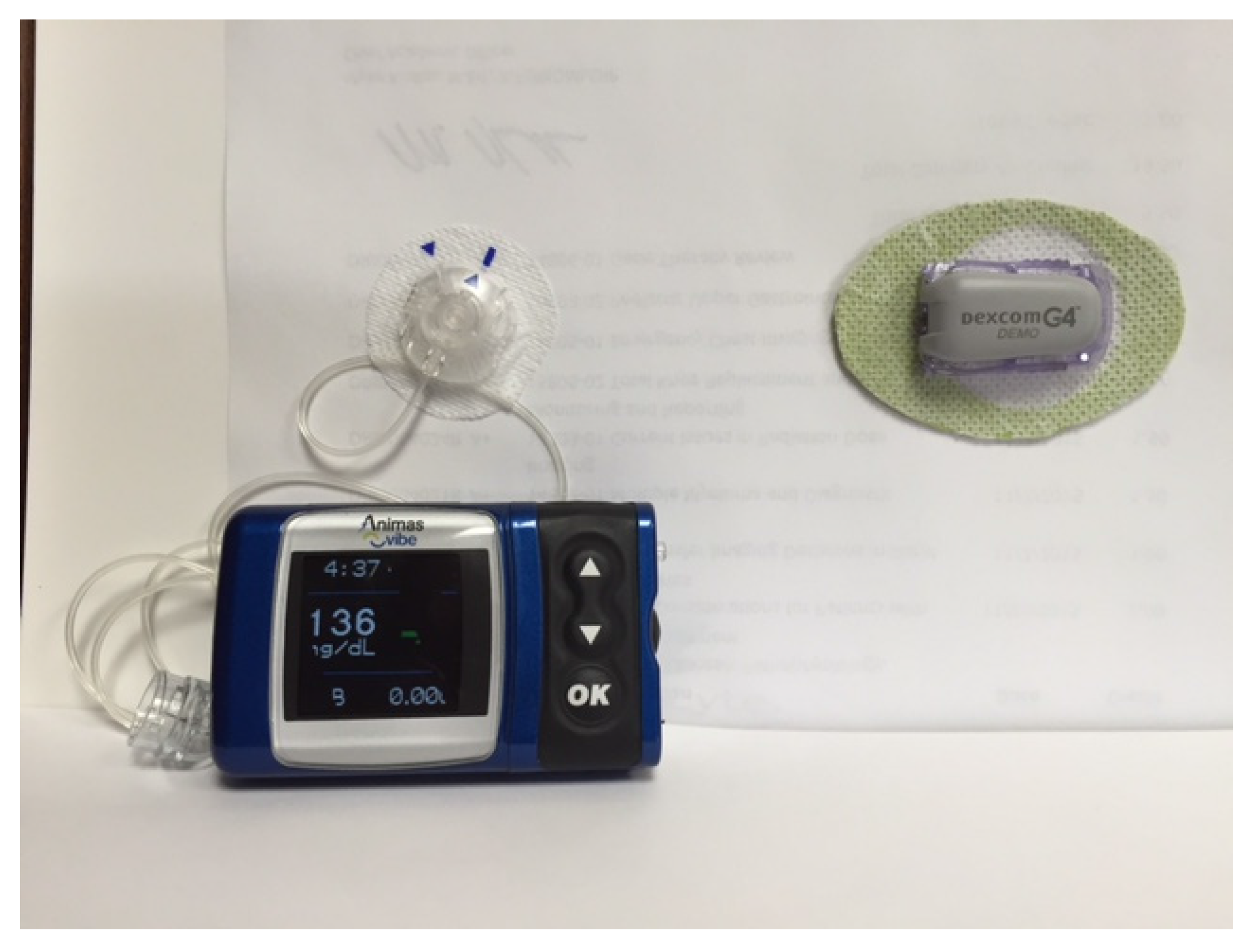 JCM Free FullText An Overview of Insulin Pumps and Glucose Sensors