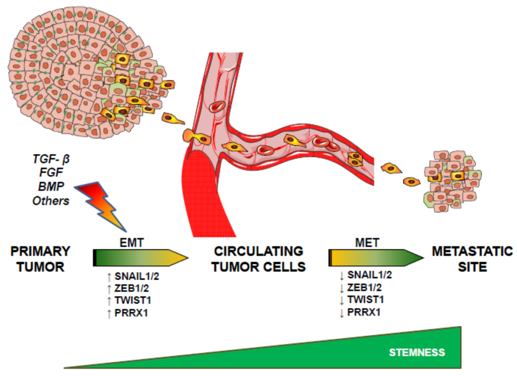 Correction Development And Cancer At The Crossroads Of Nodal And