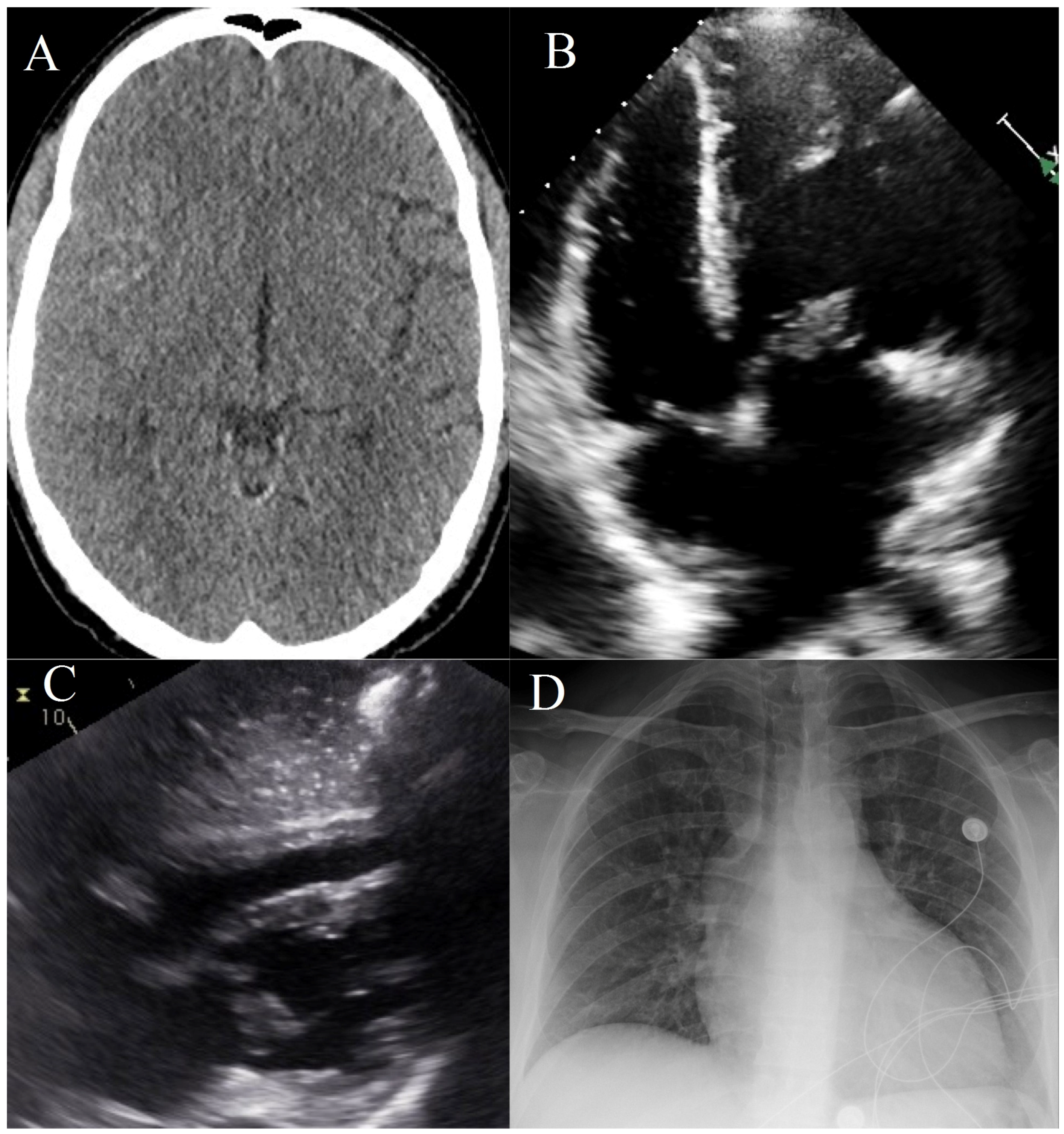 Jcm 05 00046 g001 1024