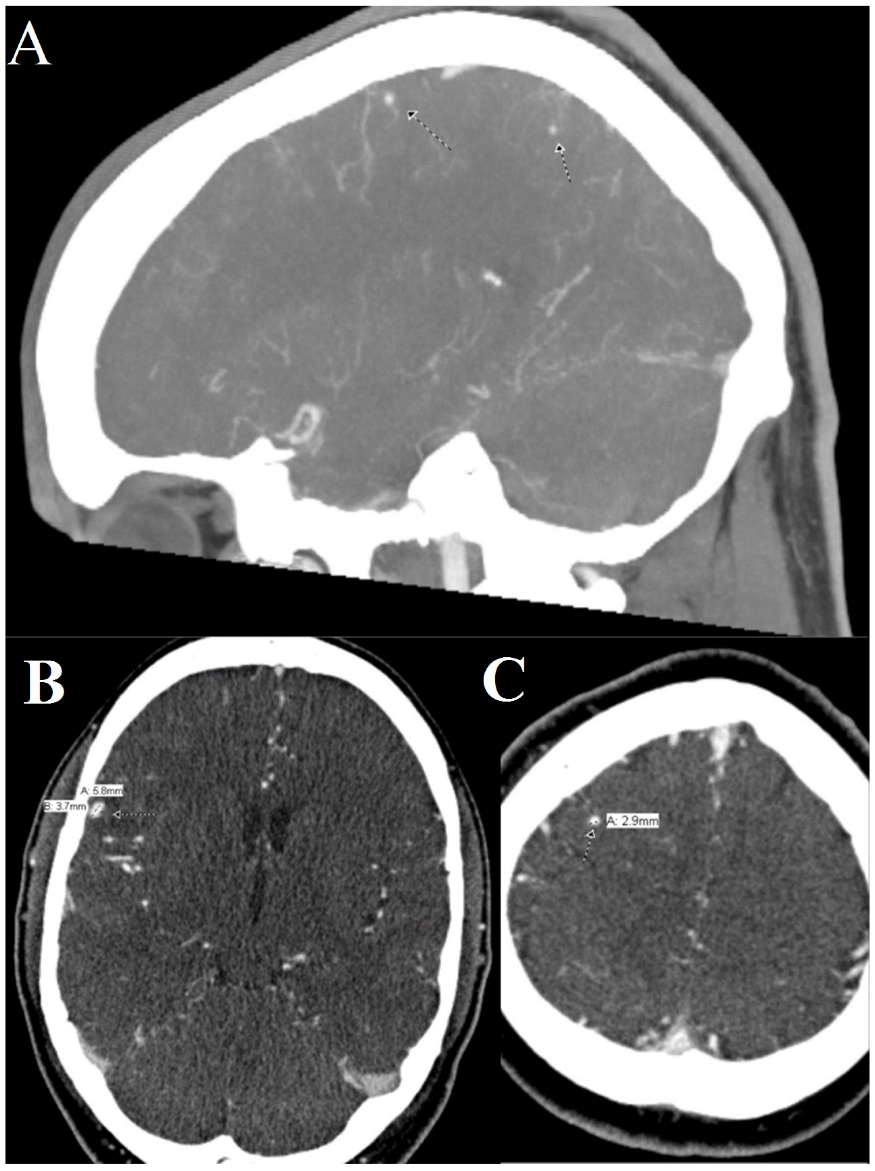 Jcm 05 00046 g002 1024
