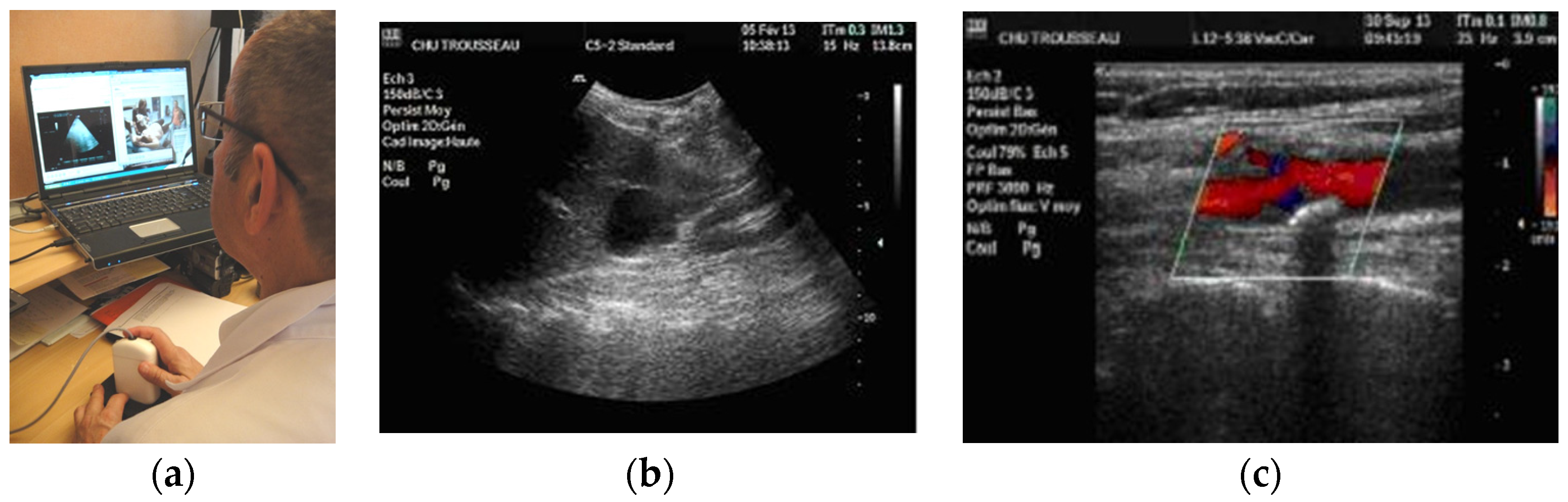 Jcm 05 00058 g002 1024