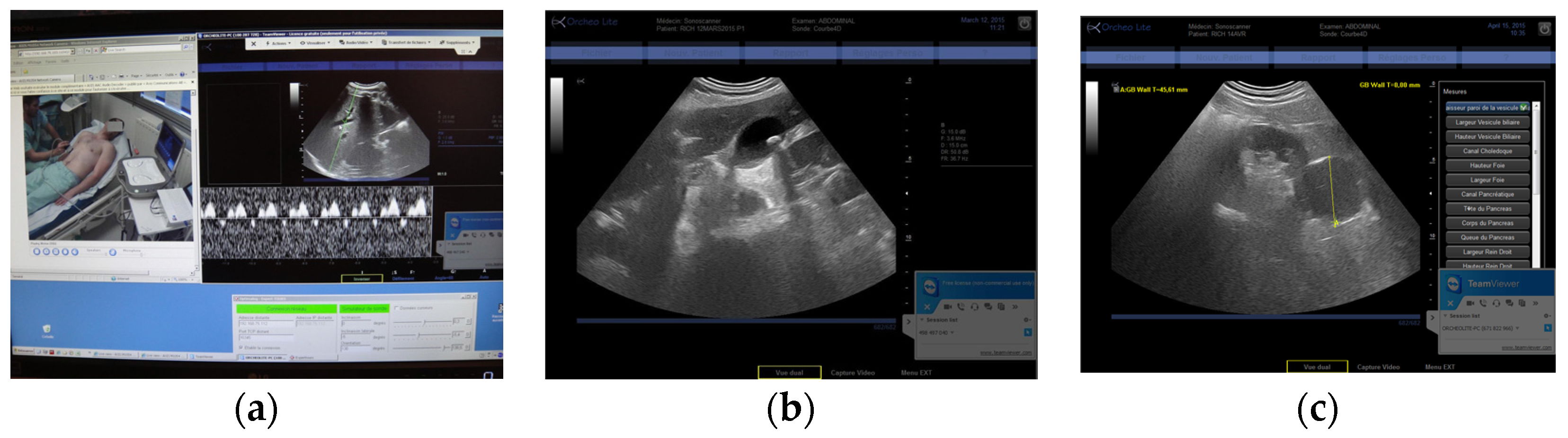 Jcm 05 00058 g004 1024