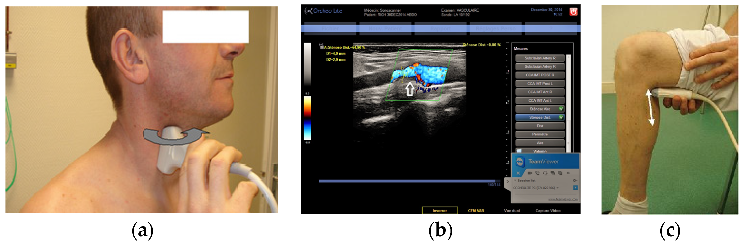 Jcm 05 00058 g005 1024