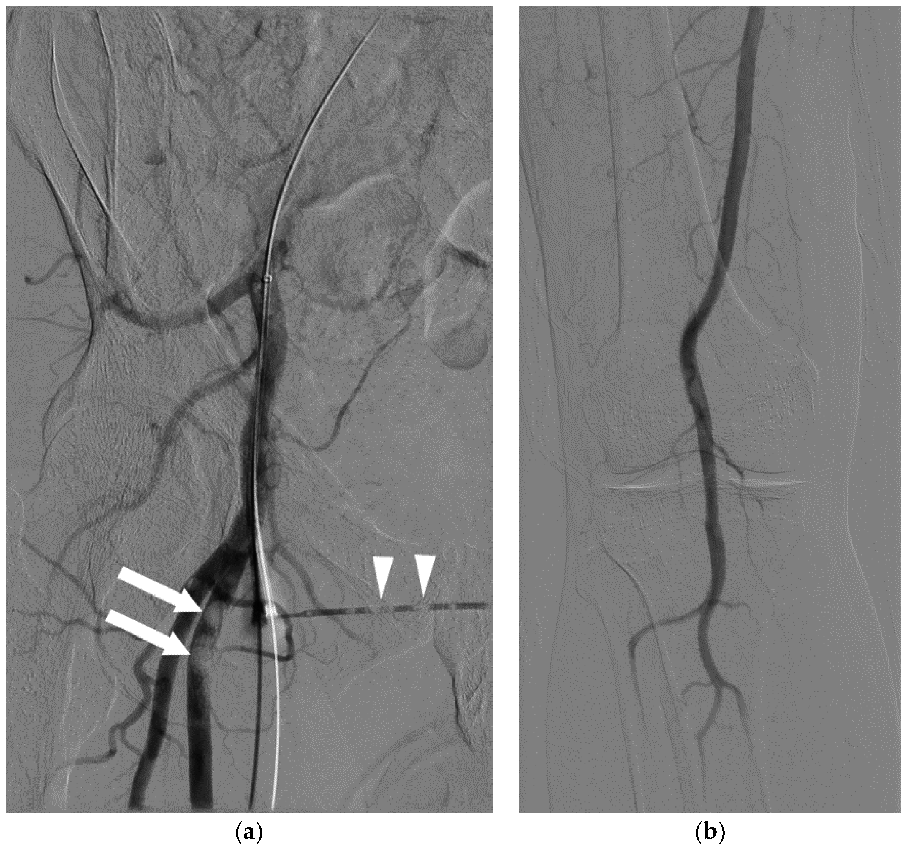 Jcm 05 00093 g002 550