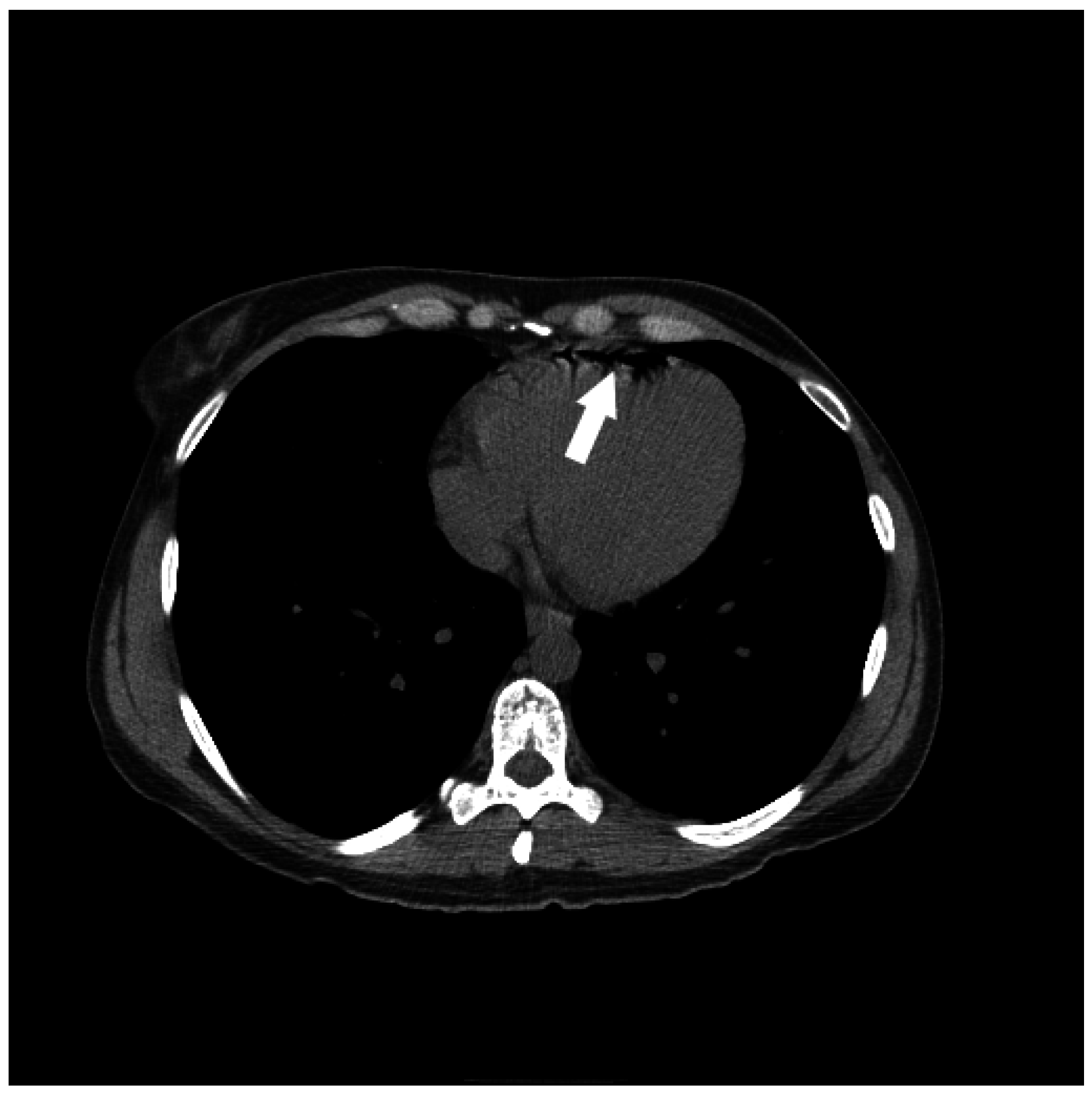 Jcm 05 00093 g005 550