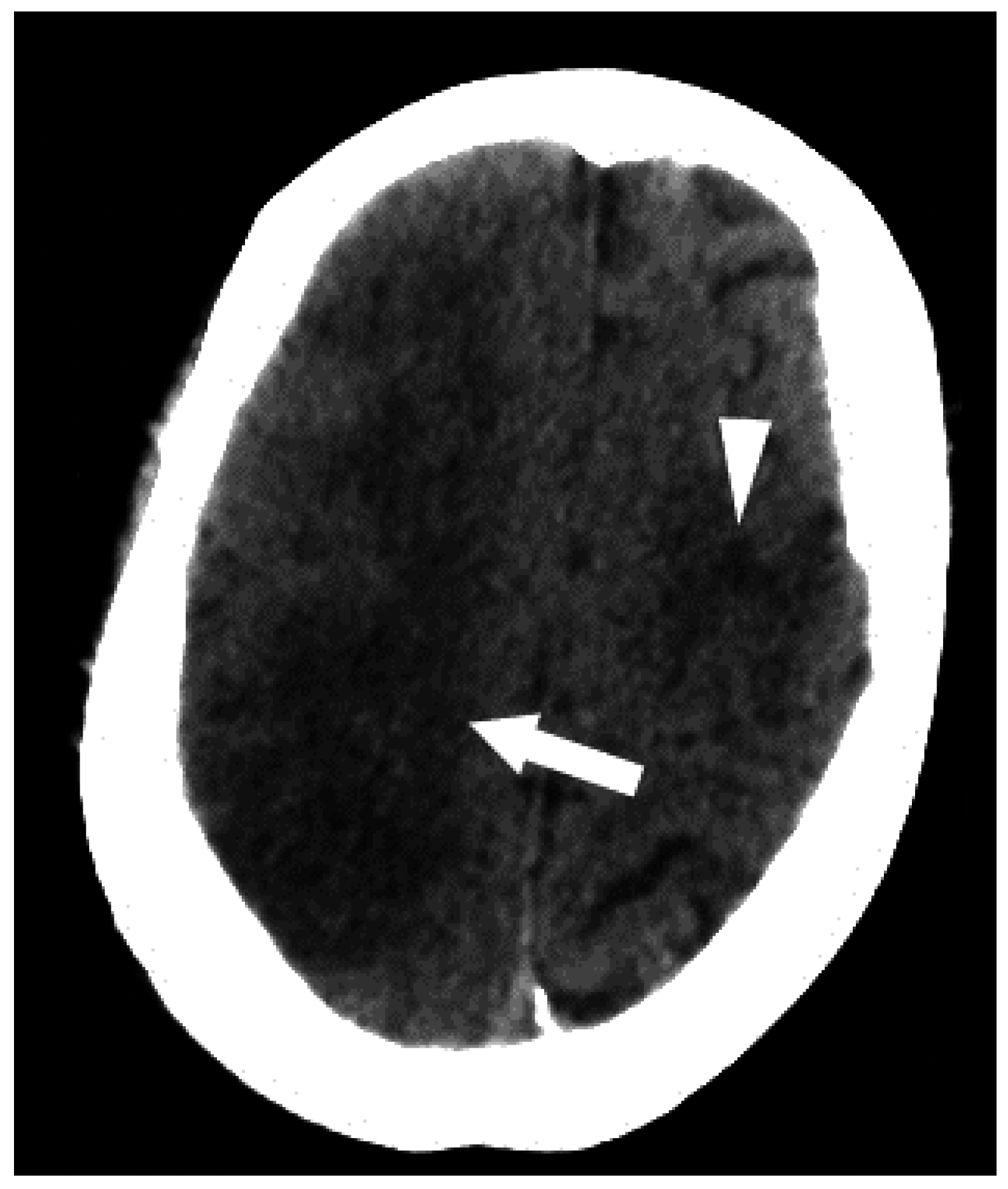 Jcm 05 00093 g006