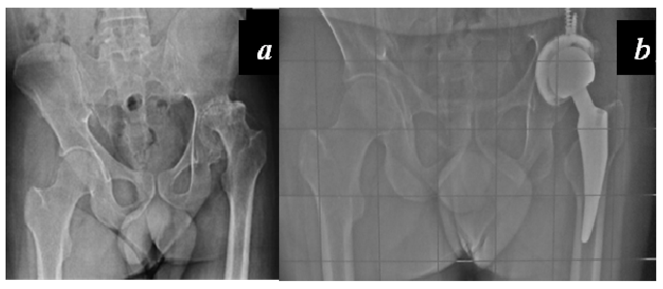 Jcm 06 00044 g004 550