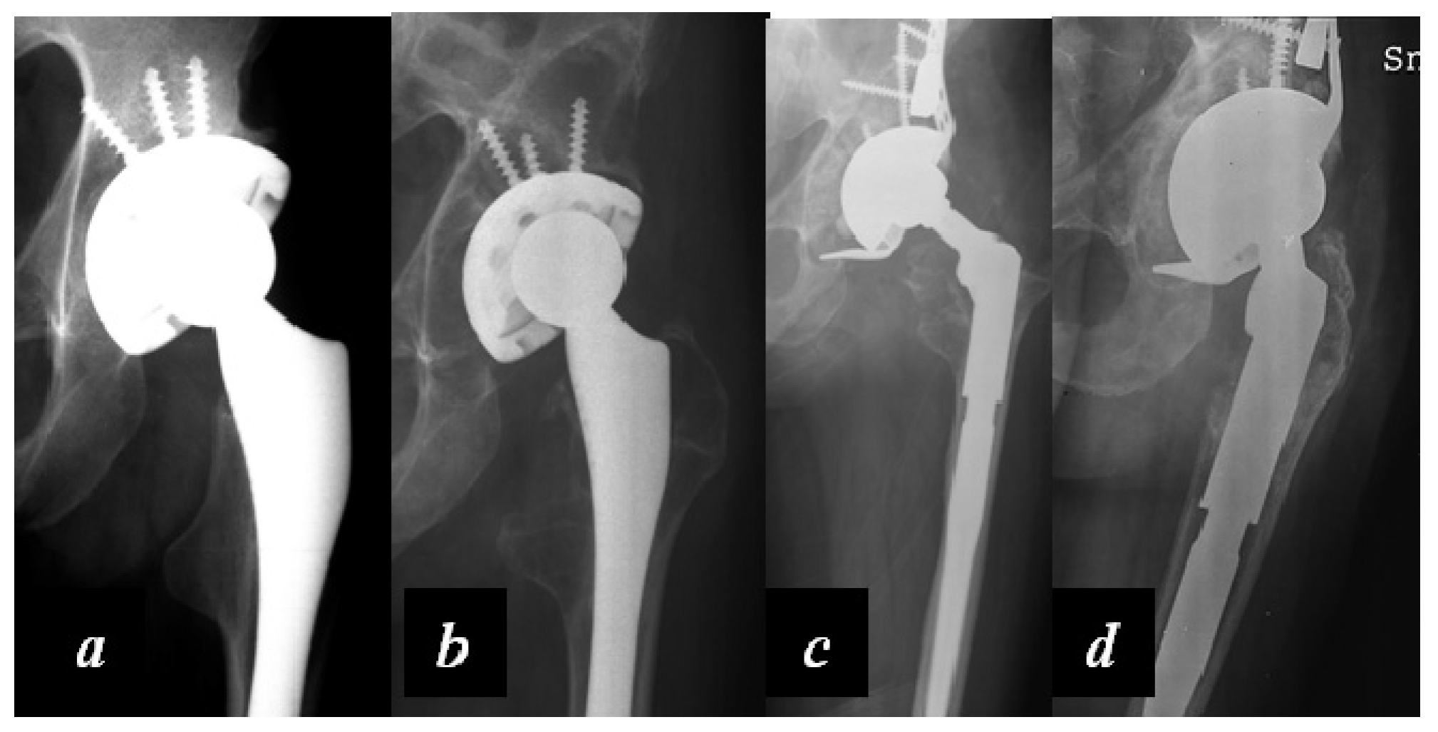 Jcm 06 00044 g005 550