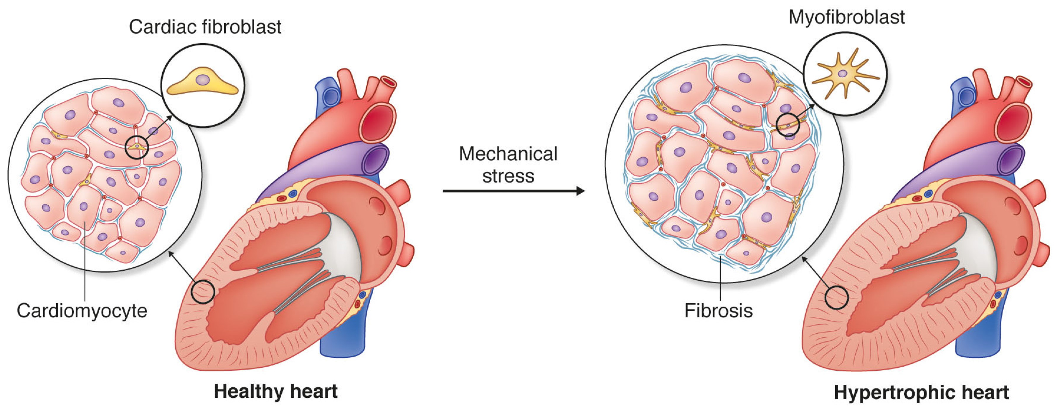 Jcm Free Full Text The Soft And Hard Heartedness Of Cardiac
