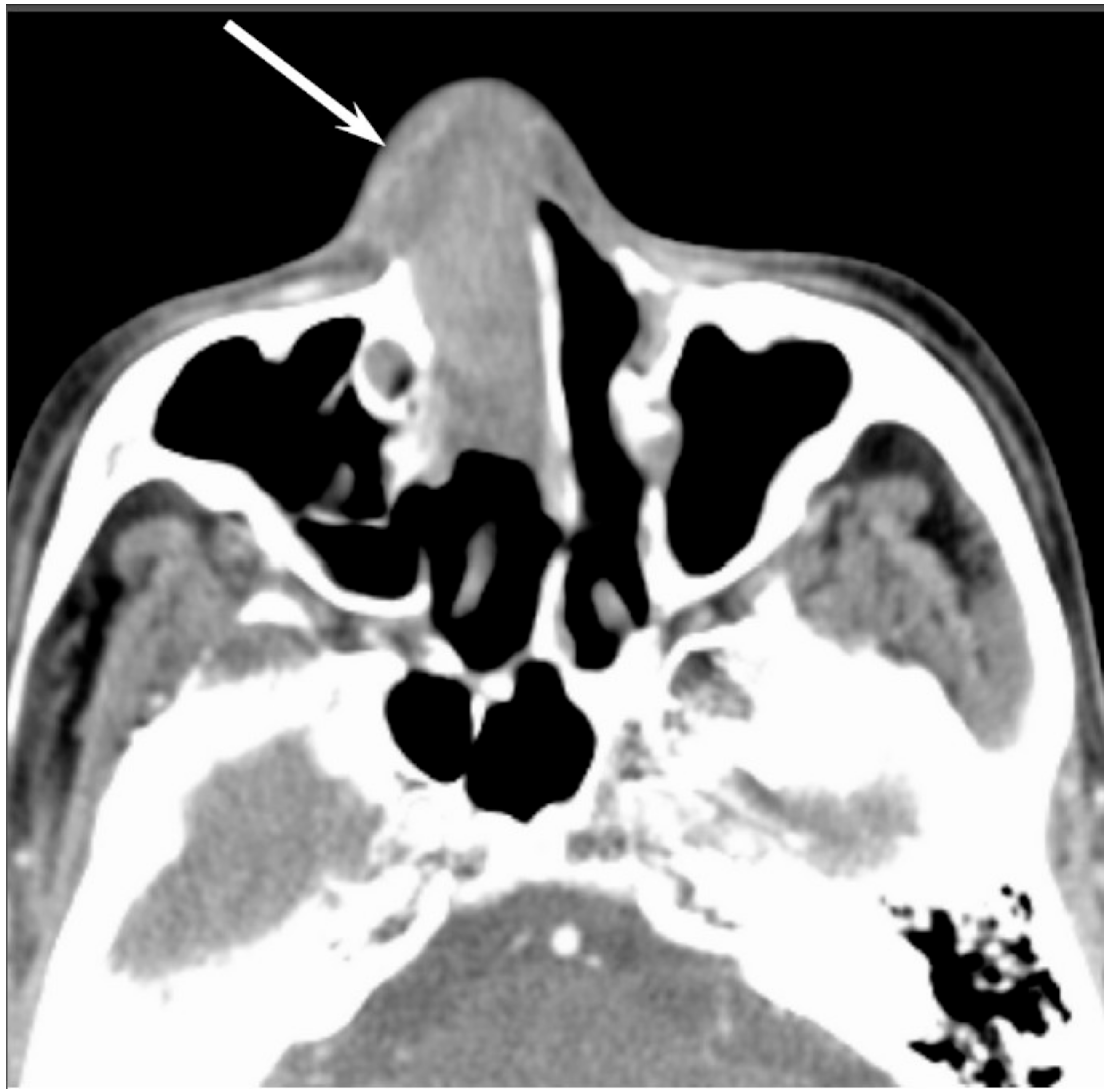 Jcm 06 00116 g004 550