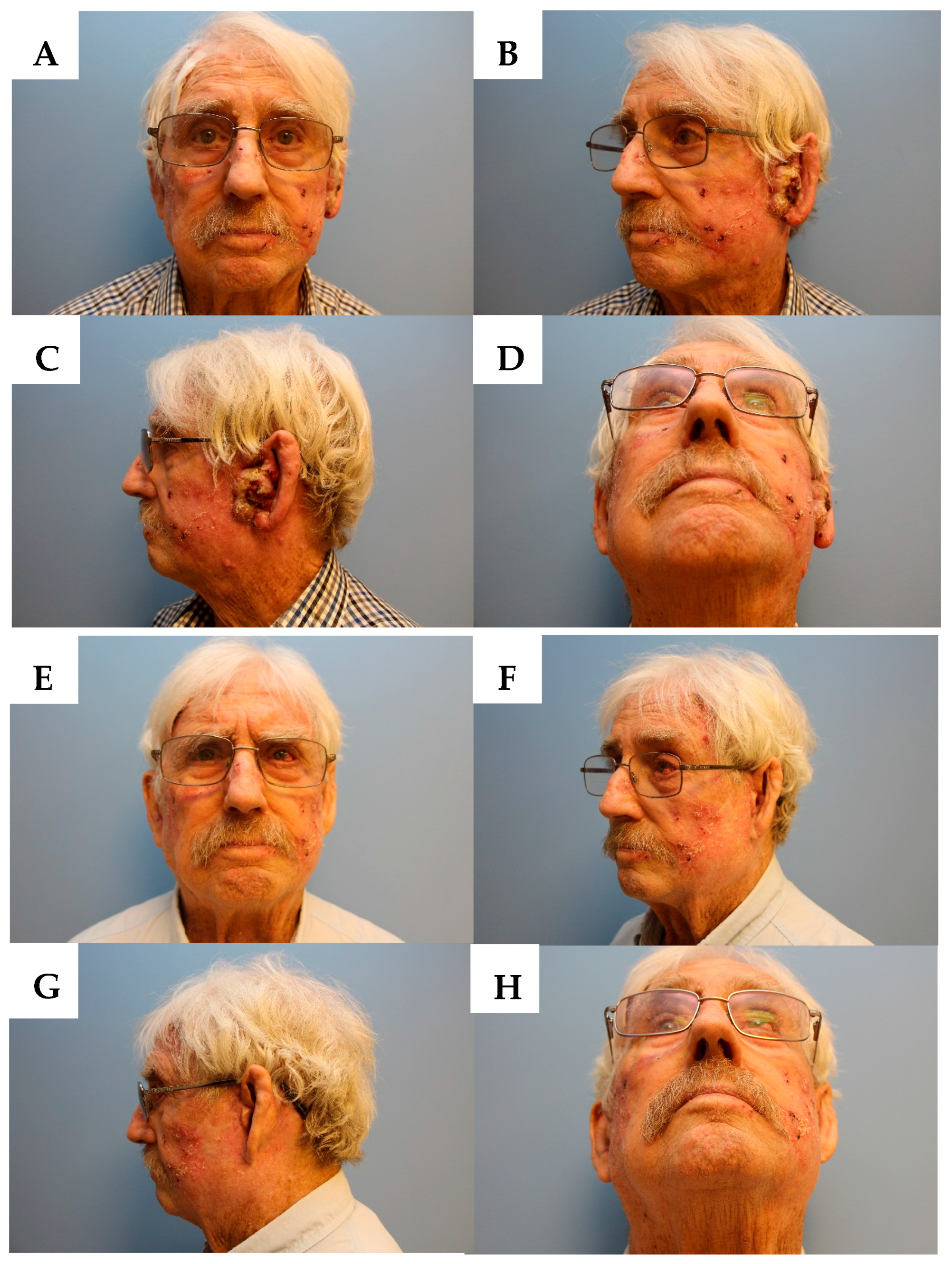 Jcm 07 00010 g001 550