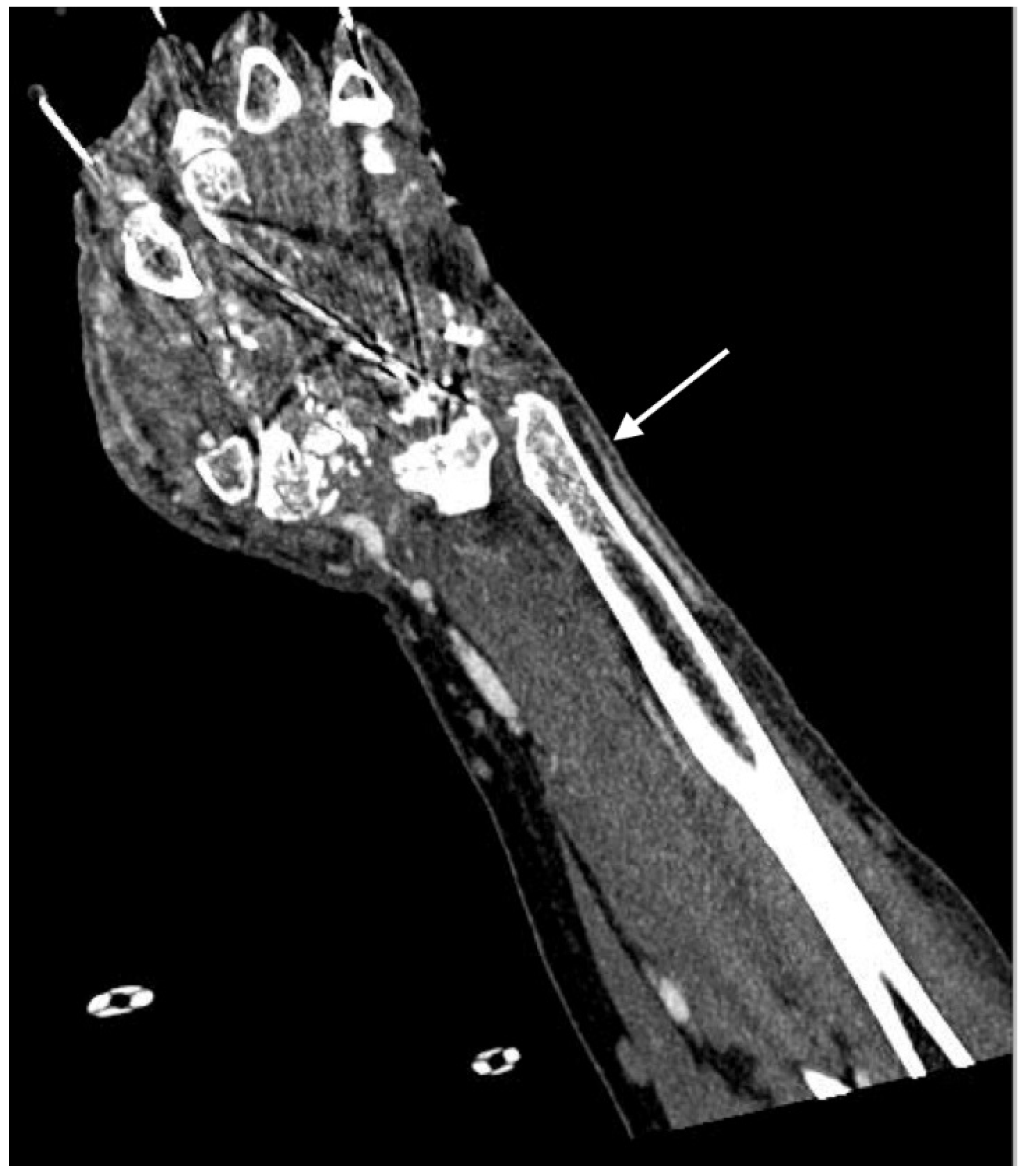 Jcm 07 00088 g005