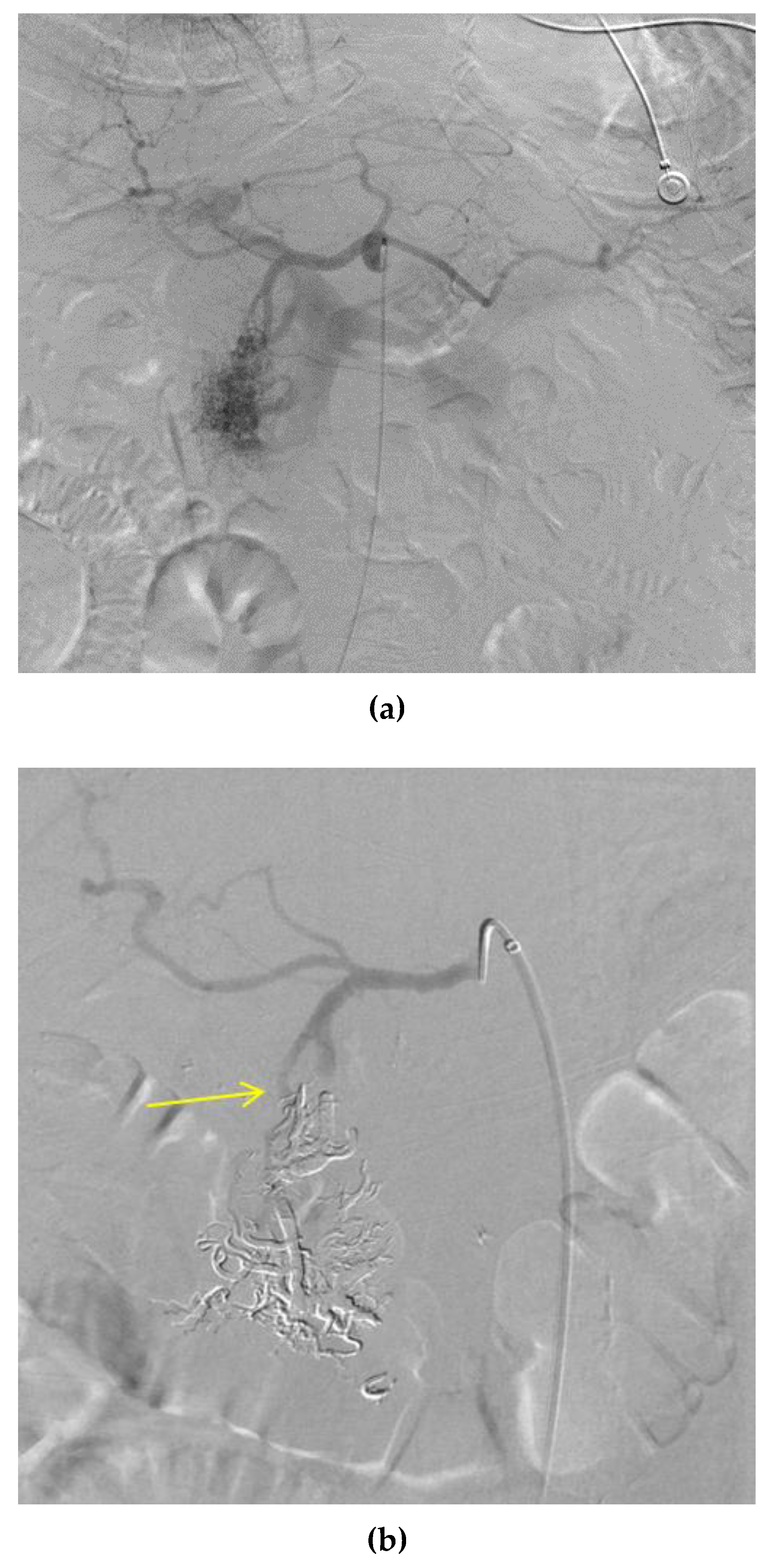 Jcm 07 00109 g004a