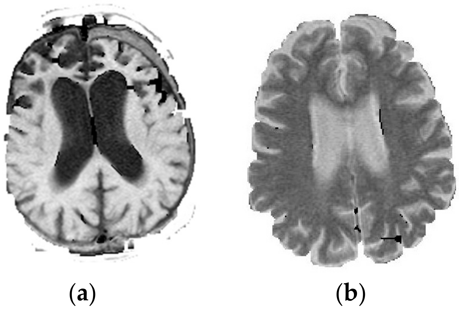 Jcm 07 00124 g002 550
