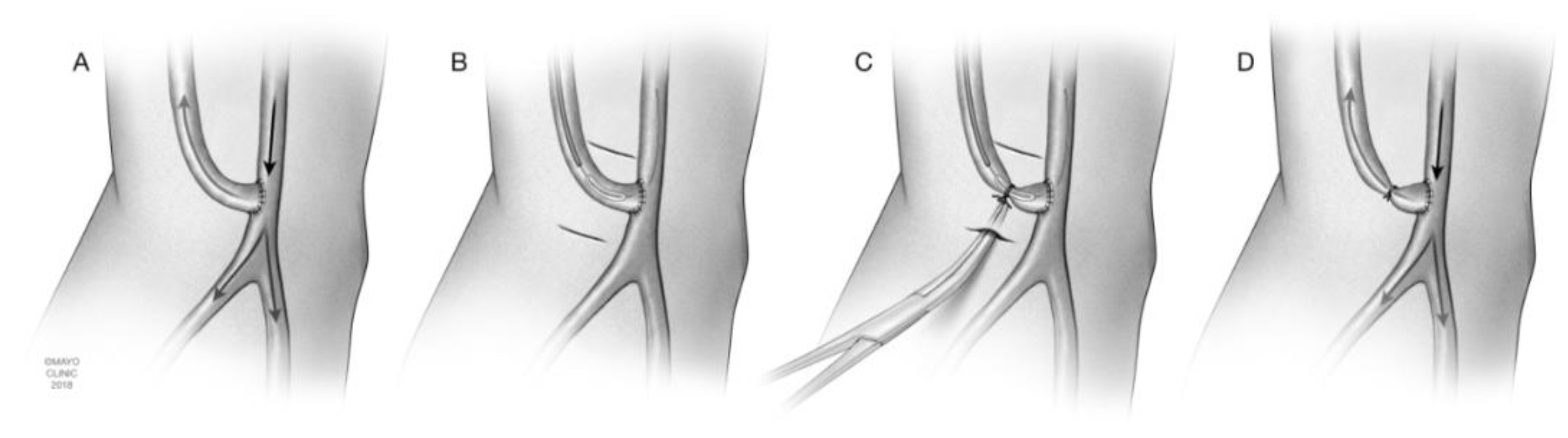 Jcm 07 00128 g004