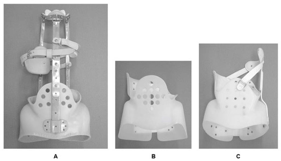 JCM Free Full Text Brace Treatment for Adolescent Idiopathic